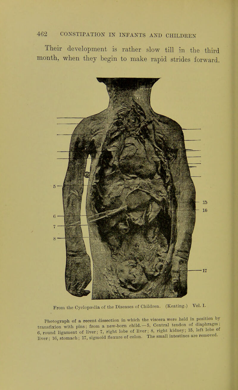 Their development is rather slow till in the third month, when they begin to make rapid strides forward. From the Cyclopjedia of the Diseases of Children. (Keating.) Vol. I. Photograph of a recent dissection in which the viscera were held in position by transfixion with pins; from a new-born child.-5, Central tendon of diaphragm; 6, round ligament of liver; 7, right lobe of liver; 8, right kidney; 15, left lobe of liver; 16, stomach; 17, sigmoid flexure of colon. The small intestines are removed.