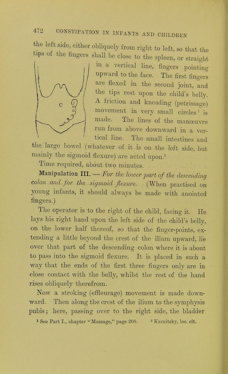 the left side, either obliquely from right to left, so that the tips of the fingers shall be close to the spleen, or straight m a vertical line, fingers jDointing upward to the face. The first fingerl are flexed in the second joint, and the tips rest upon the child's belly. A friction and kneading (petrissage) movement in very small circles ^ is made. The lines of the manoeuvre run from above downward in a ver- tical line. The small intestines and the large bowel (whatever of it is on the left side, but mainly the sigmoid flexure) are acted upon.^ Time required, about two minutes. Manipulation III.—For the lower joart of the descending colon and for the sigmoid flexure. (When practised on young infants, it should always be made with anointed fingers.) The operator is to the right of the child, facing it. He lays his right hand upon the left side of the child's belly, on the lower half thereof, so that the finger-points, ex- tending a little beyond the crest of the ilium upward, lie over that part of the descending colon where it is about to pass into the sigmoid flexure. It is placed in such a way that the ends of the first three fingers only are in close contact with the belly, whilst the rest of the hand rises obliquely therefrom. Now a stroking (effleurage) movement is made down- ward. Then along the crest of the ilium to the symphysis pubis; here, passing over to the right side, the bladder ^ See Part I., chapter Massage, page 208. ^ Karnitzky, loc. cit.