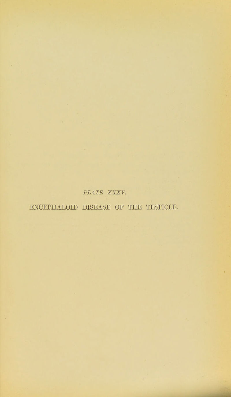 PLATE XXXV. ENCEPHALOn) DISEASE OF THE TESTICLE.