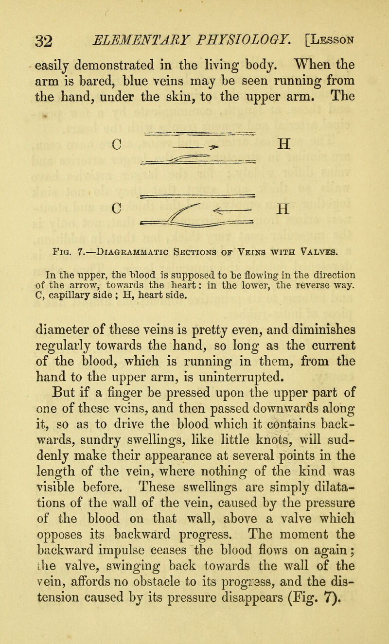 easily demonstrated in the living body. When the arm is bared, blue veins may be seen running from the hand, under the skin, to the upper arm. The C ^ H Fig. 7.—Diagrammatic Sections of Veins with Valves. In the upper, the blood is supposed to be flowing in the direction of the arrow, towards the heart: in the lower, the reverse way. C, capillary side ; H, heart side. diameter of these veins is pretty even, and diminishes regularly towards the hand, so long as the current of the blood, which is running in them, from the hand to the upper arm, is uninterrupted. But if a finger be pressed upon the upper part of one of these veins, and then passed downwards along it, so as to drive the blood which it contains back- wards, sundry swellings, like little knots, will sud- denly make their appearance at several points in the length of the vein, where nothing of the kind was visible before. These swellings are simply dilata- tions of the wall of the vein, caused by the pressure of the blood on that wall, above a valve which opposes its backward progress. The moment the backward impulse ceases the blood flows on again; the valve, swinging back towards the wall of the vein, affords no obstacle to its progress, and the dis- tension caused by its pressure disappears (Fig. 7).