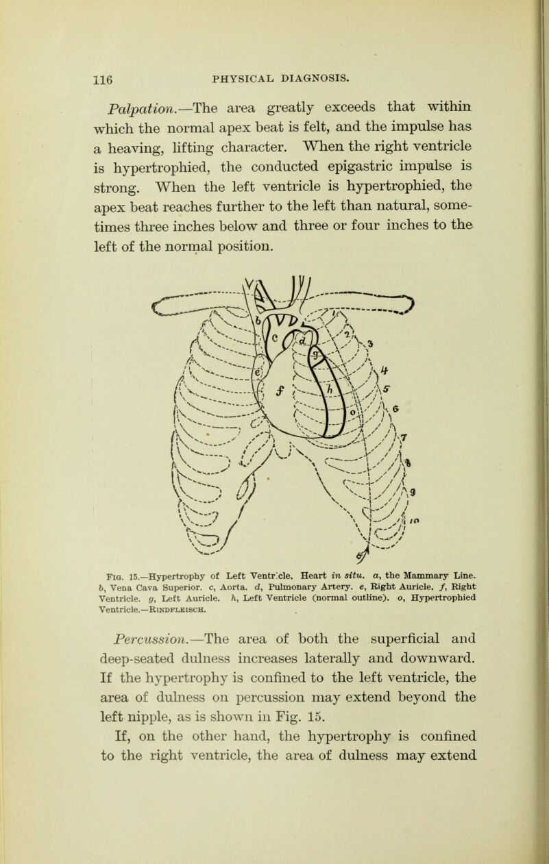 Palpation.—The area greatly exceeds that within which the normal apex beat is felt, and the impulse has a heaving, lifting character. When the right ventricle is hypertrophied, the conducted epigastric impulse is strong. When the left ventricle is hypertrophied, the apex beat reaches further to the left than natural, some- times three inches below and three or four inches to the left of the normal position. Fig. 15.—Hypertrophy of Left Ventricle. Heart in situ, a, the Mammary Line.^ 5, Vena Cava Superior, c, Aorta, d, Pulmonary Artery, e, Right Auricle. /, Right Ventricle, g, Left Auricle, h. Left Ventricle (normal outline), o, Hypertrophied Ventricle.—RiNDFLEiscH. Percussion.—The area of both the superficial and deep-seated dulness increases laterally and downward. If the hypertrophy is confined to the left ventricle, the area of dulness on percussion may extend beyond the left nipple, as is shown in Fig. 15. If, on the other hand, the hypertrophy is confined to the right ventricle, the area of dulness may extend