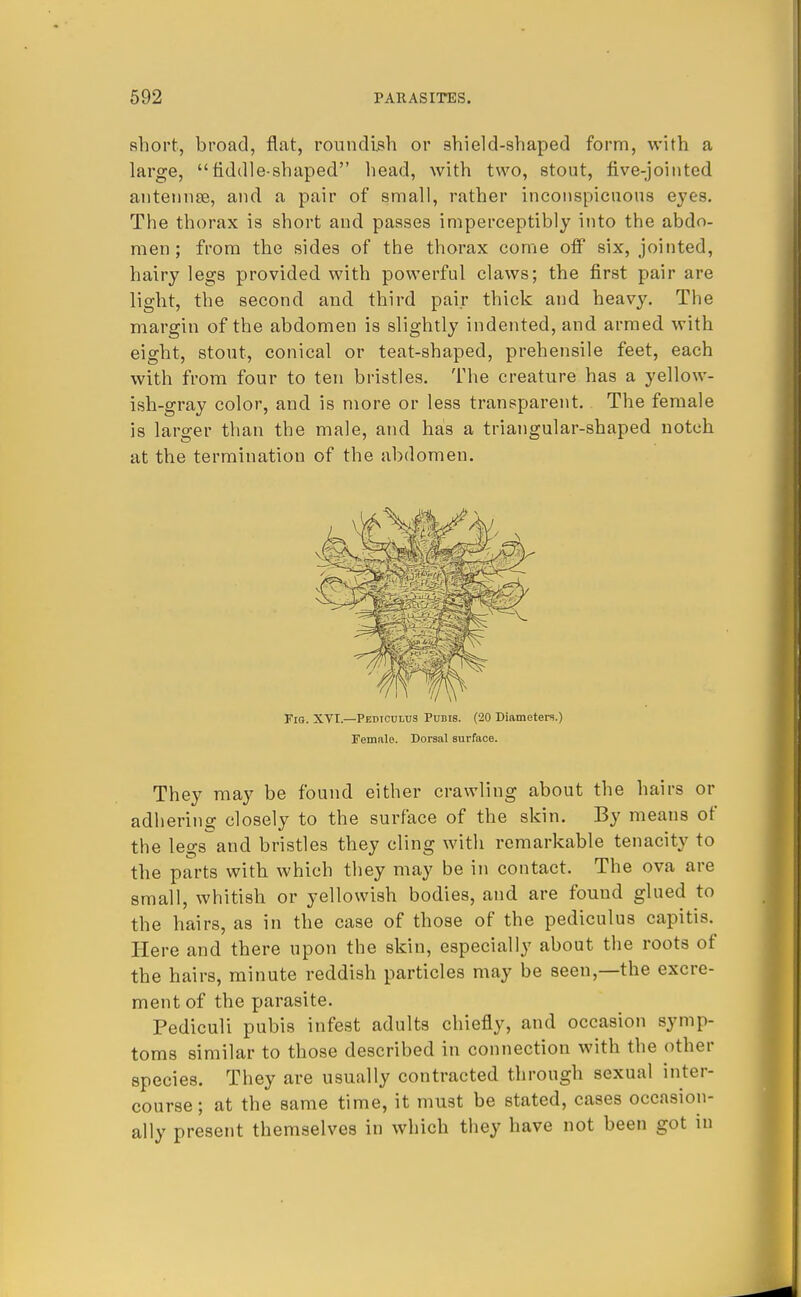 short, broad, flat, roundish or shield-shaped form, with a large, fiddle-shaped head, with two, stout, five-jointed antennae, and a pair of small, rather inconspicuous eyes. The thorax is short and passes imperceptibly into the abdo- men; from the sides of the thorax come off six, jointed, hairy legs provided with powerful claws; the first pair are light, the second and third pair thick and heavy. The margin of the abdomen is slightly indented, and armed with eight, stout, conical or teat-shaped, prehensile feet, each with from four to ten bristles. The creature has a yellow- ish-gray color, and is more or less transparent. The female is larger than the male, and has a triangular-shaped notch at the termination of the abdomen. They may be found either crawling about the hairs or adhering closely to the surface of the skin. By means of the legs and bristles they cling with remarkable tenacity to the parts with which they may be in contact. The ova are small, whitish or yellowish bodies, and are found glued to the hairs, as in the case of those of the pediculus capitis. Here and there upon the skin, especially about the roots of the hairs, minute reddish particles may be seen—the excre- ment of the parasite. Pediculi pubis infest adults chiefly, and occasion symp- toms similar to those described in connection with the other species. They are usually contracted through sexual inter- course; at the same time, it must be stated, cases occasion- ally present themselves in which they have not been got in