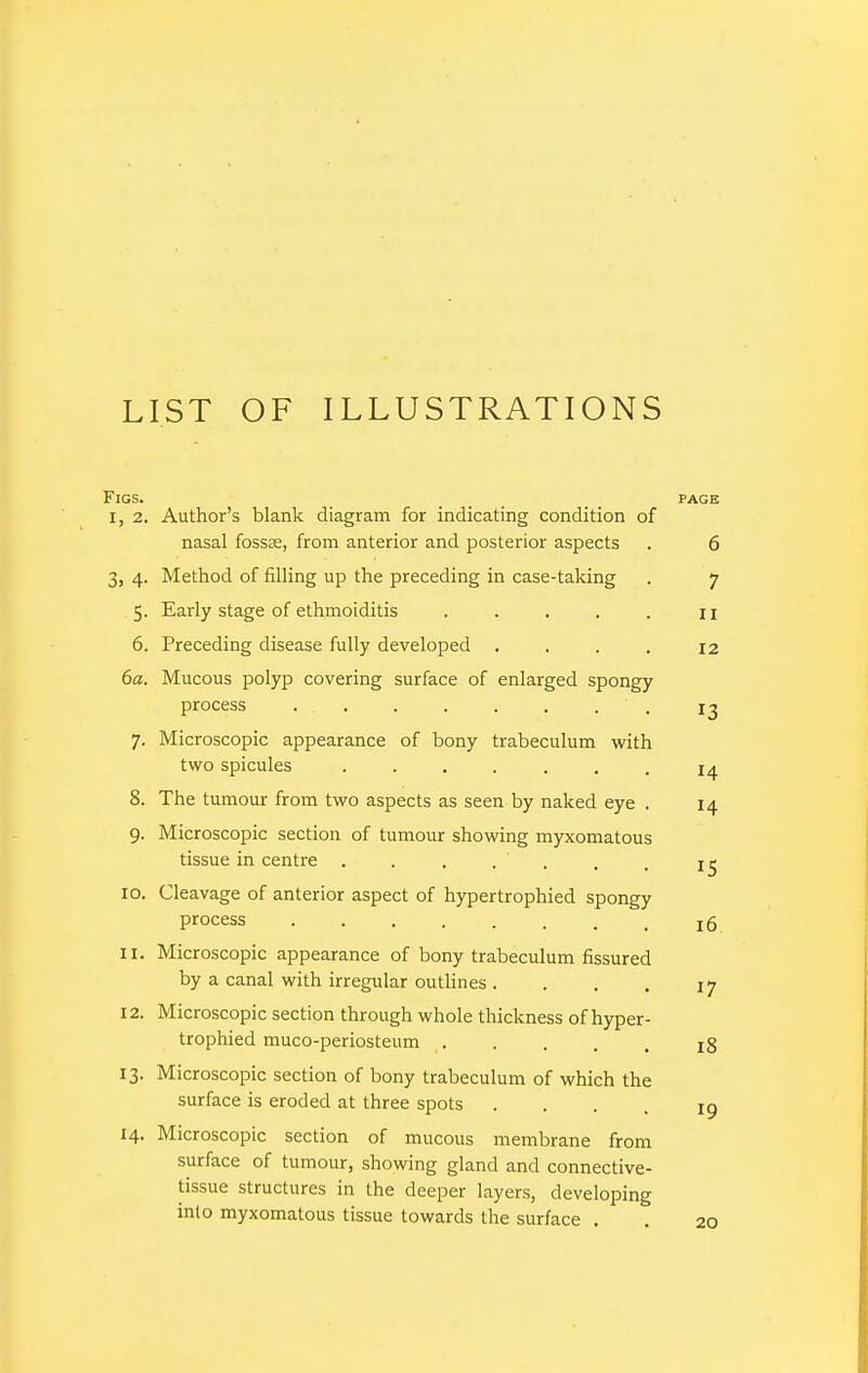 LIST OF ILLUSTRATIONS Figs. ... . . page I, 2. Author's blank diagram for indicating condition of nasal fossse, from anterior and posterior aspects . 6 3, 4. Method of filling up the preceding in case-taking . 7 5. Early stage of ethmoiditis . . , , . n 6. Preceding disease fully developed .... 12 6a. Mucous polyp covering surface of enlarged spongy process ........ 13 7. Microscopic appearance of bony trabeculum with two spicules ....... 14 8. The tumour from two aspects as seen by naked eye . 14 9. Microscopic section of tumour showing myxomatous tissue in centre . . . . . . . 10. Cleavage of anterior aspect of hypertrophied spongy process , 15 11. Microscopic appearance of bony trabeculum fissured by a canal with irregular outhnes. . . , 17 12. Microscopic section through whole tliickness of hyper- trophied muco-periosteum ig 13. Microscopic section of bony trabeculum of which the surface is eroded at three spots • . . . ig 14. Microscopic section of mucous membrane from surface of tumour, showing gland and connective- tissue structures in the deeper layers, developing into myxomatous tissue towards the surface . . 20