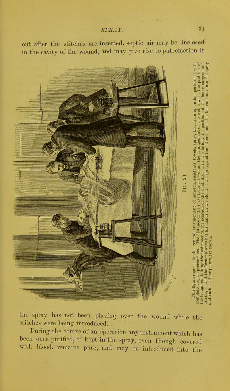 SPRAY. ?1 out after the stitches are inserted, septic air may be inclosed in the cavity of the wound, and may give rise to putrefaction if the spray has not been playing over the woimd while the stitches were being introduced. During the course of an operation any instrument which has been once purified, if kept in the spray, even though covered with blood, remains pure, and may be introduced into the