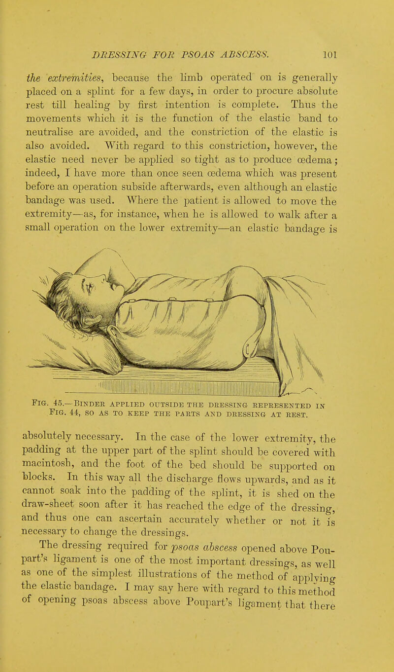 the extremities^ because the limb operated on is generally placed on a splint for a few days, in order to procure absolute rest till healing by iirst intention, is complete. Thus the movements which it is the function of the elastic band to neutralise are avoided, and the constriction of the elastic is also avoided. With regard to this constriction, however, the elastic need never be applied so tight as to produce oedema; indeed, I have more than once seen oedema which was j)resent before an operation subside afterwards, even although an elastic bandage was used. Where the patient is allowed to move the extremity—as, for instance, when he is allowed to walk after a small operation on the lower extremity—an elastic bandage is Fig. 45.—Binder applied outside the deessing represented in Fig. 44, so as to keep the parts and dressing at rest. absolutely necessary. In the case of the lower extremity, the padding at the upper part of the splint should be covered with macintosh, and the foot of the bed should be supported on blocks. In this way all the discharge flows upwards, and as it cannot soak into the padding of the splint, it is shed on the draw-sheet soon after it has reached the edge of the dressing, and thus one can ascertain accurately whether or not it is necessary to change the dressings. The dressing required for jpsoas abscess opened above Pou- part's ligament is one of the most important dressings, as well as one of the simplest illustrations of the method of applying the elastic bandage. I may say here with regard to this method of opening psoas abscess above Poupart's ligament that there (