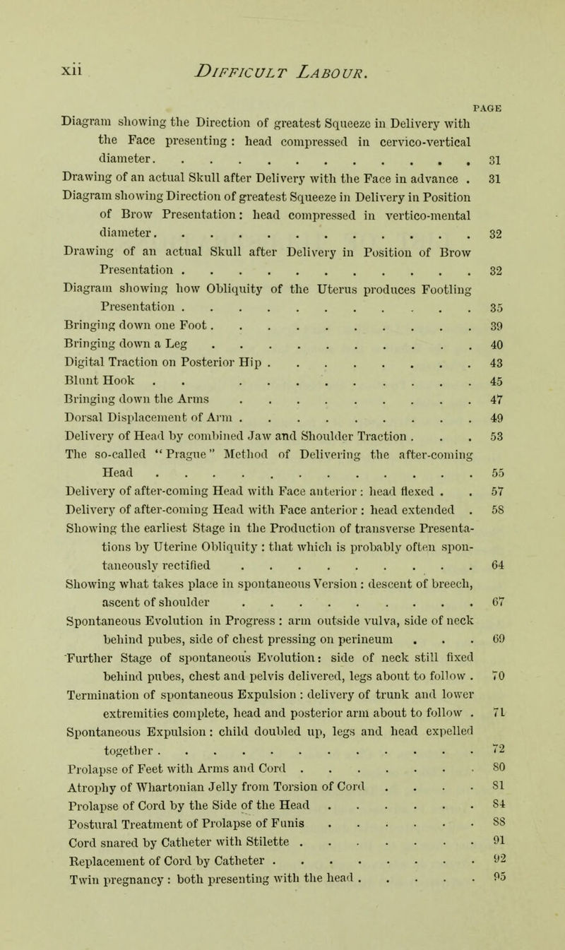 PAGE Diagram showing the Direction of greatest Squeeze in Delivery with the Face presenting : head compressed in cervico-vertical diameter 31 Drawing of an actual Skull after Delivery with the Face in advance . 31 Diagram showing Direction of greatest Squeeze in Delivery in Position of Brow Presentation: head compressed in vertico-mental diameter 32 Drawing of an actual Skull after Delivery in Position of Brow Presentation 32 Diagram showing how Obliquity of the Uterus produces Footling- Presentation 35 Bringing down one Foot 39 Bringing down a Leg 40 Digital Traction on Posterior Hip 43 Blunt Hook . . 45 Bringing down the Arms 47 Dorsal Displacement of Arm 49 Delivery of Head by combined Jaw and Shoulder Traction ... 53 The so-called  Prague Method of Delivering the after-coming Head 55 Delivery of after-coming Head with Face anterior : head flexed . . 57 Delivery of after-coming Head with Face anterior : head extended . 58 Showing the earliest Stage in the Production of transverse Presenta- tions by Uterine Obliquity : that which is probably often spon- taneously rectified 64 Showing what takes place in spontaneous Version : descent of breech, ascent of shoulder 67 Spontaneous Evolution in Progress : arm outside vulva, side of neck behind pubes, side of chest pressing on perineum ... 69 Further Stage of spontaneous Evolution: side of neck still fixed behind pubes, chest and pelvis delivered, legs about to follow . 70 Termination of spontaneous Expulsion : delivery of trunk and lower extremities complete, head and posterior arm about to follow . 71 Spontaneous Expulsion: child doubled up, legs and head expelled together ,.. , . . 72 Prolapse of Feet with Arms and Cord SO Atrophy of Whartonian Jelly from Torsion of Cord .... SI Prolapse of Cord by the Side of the Head S4 Postural Treatment of Prolapse of Funis SS Cord snared by Catheter with Stilette 91 Replacement of Cord by Catheter 92 Twin pregnancy : both presenting with the head 95