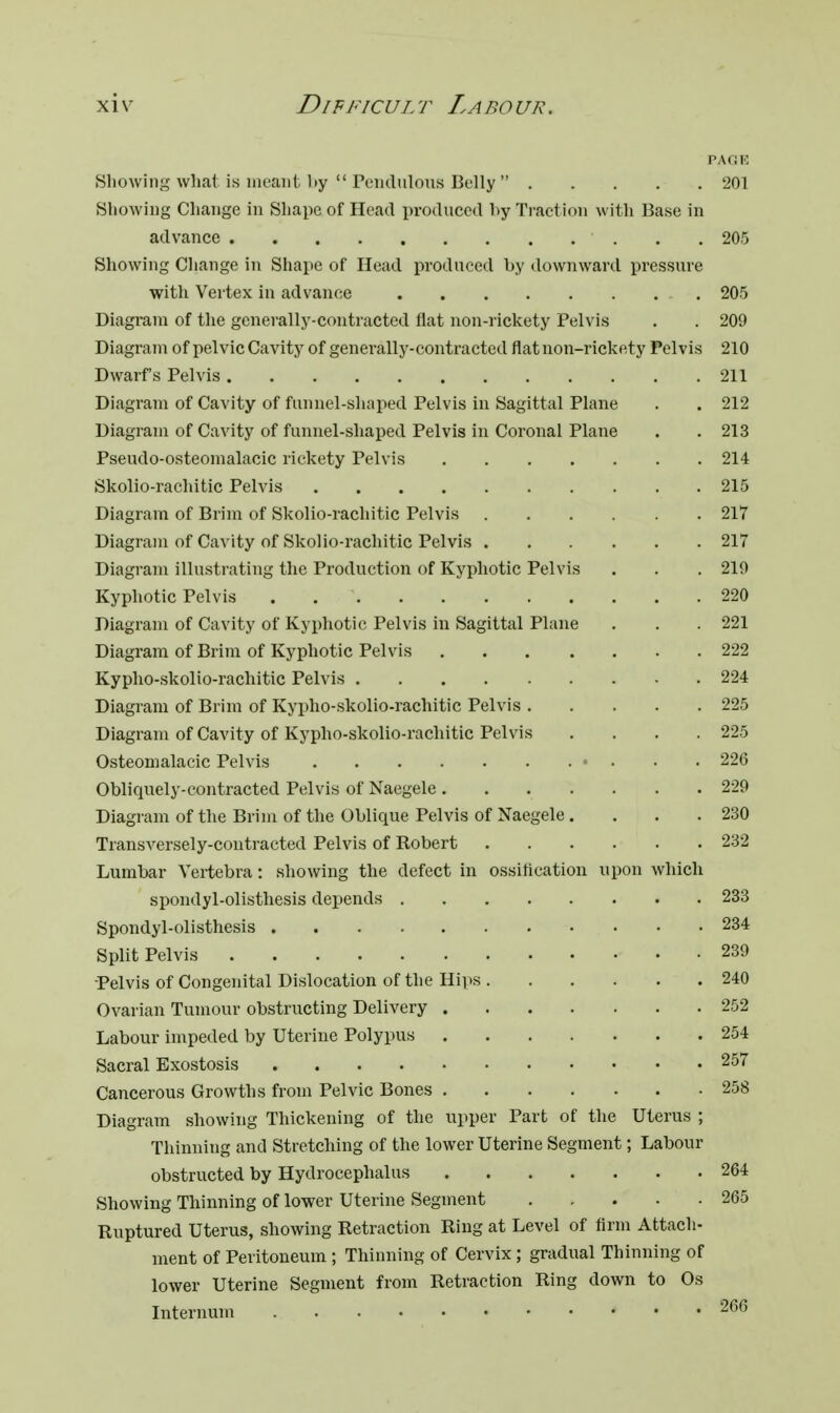 PA OK Showing what is meant by  Pendulous Belly  201 Showing Change in Shape of Head produced by Traction with Base in advance 205 Showing Change in Shape of Head produced by downward pressure with Vertex in advance . 205 Diagram of the generally-contracted flat non-rickety Pelvis . . 209 Diagram of pelvic Cavity of generally-contracted flat non-rickety Pelvis 210 Dwarfs Pelvis 211 Diagram of Cavity of funnel-shaped Pelvis in Sagittal Plane . . 212 Diagram of Cavity of funnel-shaped Pelvis in Coronal Plane . . 213 Pseudo-osteomalacic rickety Pelvis 214 Skolio-rachitic Pelvis 215 Diagram of Brim of Skolio-rachitic Pelvis 217 Diagram of Cavity of Skolio-rachitic Pelvis 217 Diagram illustrating the Production of Kyphotic Pelvis . . . 219 Kyphotic Pelvis . 220 Diagram of Cavity of Kyphotic Pelvis in Sagittal Plane . . . 221 Diagram of Brim of Kyphotic Pelvis 222 Kypho-skolio-rachitic Pelvis 224 Diagram of Brim of Kypho-skolio-rachitic Pelvis 225 Diagram of Cavity of Kypho-skolio-rachitic Pelvis .... 225 Osteomalacic Pelvis 226 Obliquely-contracted Pelvis of Naegele 229 Diagram of the Brim of the Oblique Pelvis of Naegele . . . .230 Transversely-contracted Pelvis of Robert 232 Lumbar Vertebra: showing the defect in ossification upon which spondylolisthesis depends 233 Spondylolisthesis 234 Split Pelvis . . 239 Pelvis of Congenital Dislocation of the Hips 240 Ovarian Tumour obstructing Delivery 252 Labour impeded by Uterine Polypus 254 Sacral Exostosis 257 Cancerous Growths from Pelvic Bones 258 Diagram showing Thickening of the upper Part of the Uterus ; Thinning and Stretching of the lower Uterine Segment; Labour obstructed by Hydrocephalus 264 Showing Thinning of lower Uterine Segment 265 Ruptured Uterus, showing Retraction Ring at Level of firm Attach- ment of Peritoneum ; Thinning of Cervix; gradual Thinning of lower Uterine Segment from Retraction Ring down to Os Internum 266