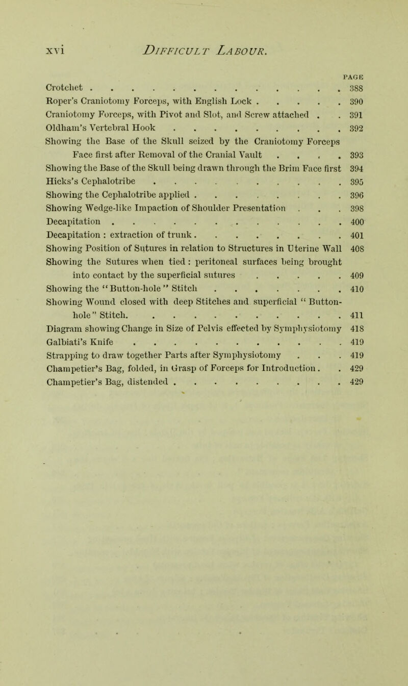 PAGE Crotchet 388 Roper's Craniotomy Forceps, with English Lock 390 Craniotomy Forceps, with Pivot and Slot, and Screw attached . . 391 Oldham's Vertebral Hook 392 Showing the Base of the Skull seized by the Craniotomy Forceps Face first after Removal of the Cranial Vault .... 393 Showing the Base of the Skull being drawn through the Brim Face first 394 Hicks's Cephalotribe 395 Showing the Cephalotribe applied 396 Showing Wedge-like Impaction of Shoulder Presentation . . 398 Decapitation 400 Decapitation : extraction of trunk 401 Showing Position of Sutures in relation to Structures in Uterine Wall 408 Showing the Sutures when tied : peritoneal surfaces being brought into contact by the superficial sutures 409 Showing the Button-hole  Stitch 410 Showing Wound closed with deep Stitches and superficial  Button- hole Stitch 411 Diagram showing Change in Size of Pelvis effected by Symphysiotomy 418 Galbiati's Knife 419 Strapping to draw together Parts after Symphysiotomy . . .419 Champetier's Bag, folded, in Grasp of Forceps for Introduction . . 429 Champetier's Bag, distended 429