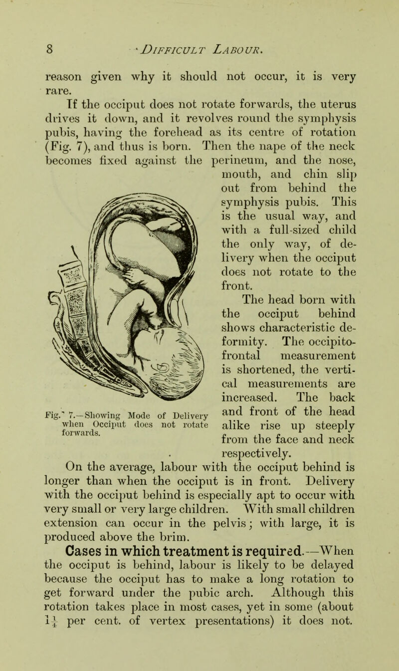 reason given why it should not occur, it is very rare. If the occiput does not rotate forwards, the uterus drives it down, and it revolves round the symphysis pubis, having the forehead as its centre of rotation (Fig. 7), and thus is born. Then the nape of the neck becomes fixed against the perineum, and the nose, mouth, and chin slip out from behind the symphysis pubis. This is the usual way, and with a full-sized child the only way, of de- livery when the occiput does not rotate to the front. The head born with the occiput behind shows characteristic de- formity. The occipito- frontal measurement is shortened, the verti- cal measurements are increased. The back and front of the head alike rise up steeply from the face and neck respectively. On the average, labour with the occiput behind is longer than when the occiput is in front. Delivery with the occiput behind is especially apt to occur with very small or very large children. With small children extension can occur in the pelvis; with large, it is produced above the brim. Cases in which treatment is required.—When the occiput is behind, labour is likely to be delayed because the occiput has to make a long rotation to get forward under the pubic arch. Although this rotation takes place in most cases, yet in some (about 1], per cent, of vertex presentations) it does not. Fig.' 7.—Showing Mode of Delivery when Occiput does not rotate forwards.