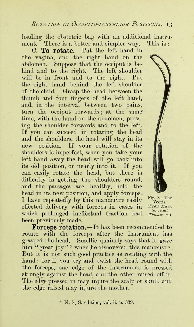 loading the obstetric bag with an additional instru- ment. There is a better and simpler way. This is : 0. To rotate.—-Put the left hand in the vagina, and the right hand on the abdomen. Suppose that the occiput is be- hind and to the right. The left shoulder will be in front and to the right. Put the right hand behind the left shoulder of the child. Grasp the head between the thumb and four fingers of the left hand, and, in the interval between two pains, turn the occiput forwards; at the same* time, with the hand on the abdomen, press- ing the shoulder forwards and to the left. If you can succeed in rotating the head and the shoulders, the head will stay in its new position. If your rotation of the shoulders is imperfect, when you take your left hand away the head will go back into its old position, or nearly into it. If you can easily rotate the head, but there is difficulty in getting the shoulders round, and the passages are healthy, hold the head in its new position, and apply forceps. I have repeatedly by this manoeuvre easily effected delivery with forceps in cases in (From Maw, which prolonged ineffectual traction had Thompson.) been previously made. Forceps rotation.—It has been recommended to rotate with the forceps after the instrument has grasped the head. Smellie quaintly says that it gave him great joy  * when he discovered this manoeuvre. But it is not such good practice as rotating with the hand : for if you try and twist the head round with the forceps, one edge of the instrument is pressed strongly against the head, and the other raised off it. The edge pressed in may injure the scalp or skull, and the edge raised may injure the mother. * N. S. S. edition, vol. ii. p. 339.