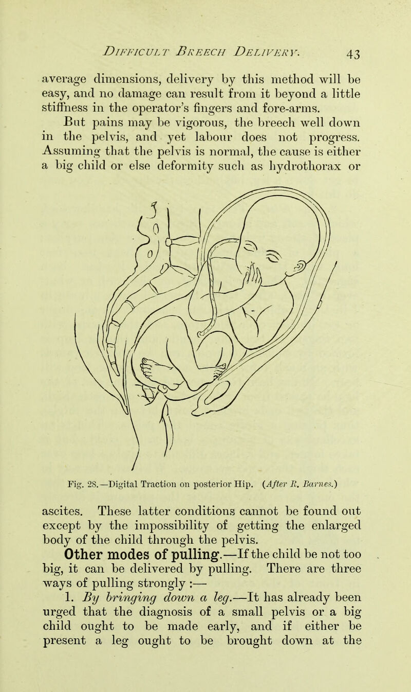 Difficult Breech Delivery. average dimensions, delivery by this method will be easy, and no damage can result from it beyond a little stiffness in the operator's fingers and fore-arms. But pains may be vigorous, the breech well down in the pelvis, and yet labour does not progress. Assuming that the pelvis is normal, the cause is either a big child or else deformity such as hydrothorax or Fig. 2S.—Digital Traction on posterior Hip. (After R. Barnes.) ascites. These latter conditions cannot be found out except by the impossibility of getting the enlarged body of the child through the pelvis. Other modes of pulling.—If the child be not too big, it can be delivered by pulling. There are three ways of pulling strongly :— 1. By bringing down a leg.—It has already been urged that the diagnosis of a small pelvis or a big child ought to be made early, and if either be present a leg ought to be brought down at the