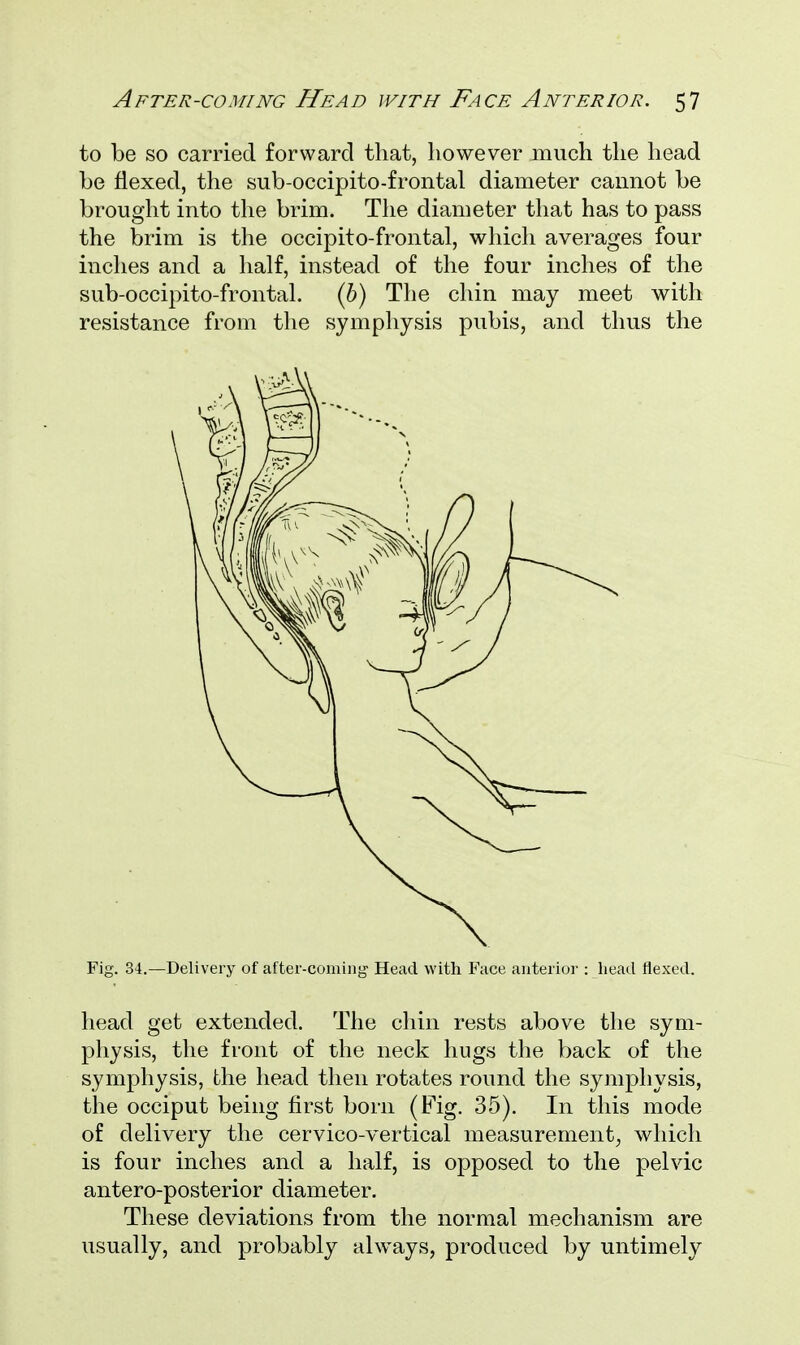 to be so carried forward that, however much the head be flexed, the sub-occipito-frontal diameter cannot be brought into the brim. The diameter that has to pass the brim is the occipitofrontal, which averages four inches and a half, instead of the four inches of the sub-occipito-frontal. (b) The chin may meet with resistance from the symphysis pubis, and thus the Fig. 34.—Delivery of after-coming' Head with Face anterior : head flexed. head get extended. The chin rests above the sym- physis, the front of the neck hugs the back of the symphysis, the head then rotates round the symphysis, the occiput being first born (Fig. 35). In this mode of delivery the cervico-vertical measurement, which is four inches and a half, is opposed to the pelvic antero-posterior diameter. These deviations from the normal mechanism are usually, and probably always, produced by untimely