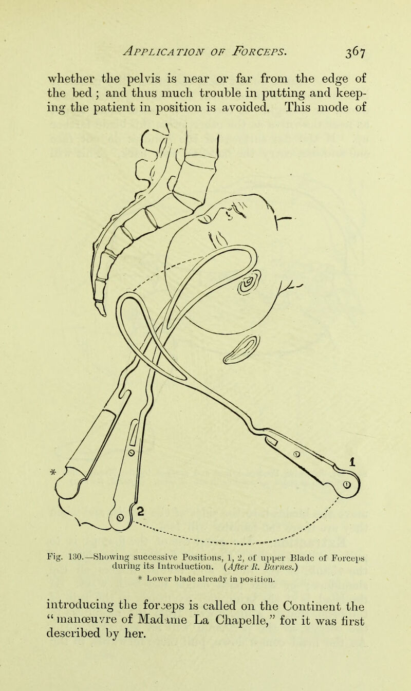 whether the pelvis is near or far from the edge of the bed ; and thus much trouble in putting and keep- ing the patient in position is avoided. This mode of Fig. 130.—Showing successive Positions, 1, 2, of upper Blade of Forceps during its Introduction. {After R. Barnes.) * Lower blade already in position. introducing the forjeps is called on the Continent the  manoeuvre of Mad ime La Chapelle, for it was first described by her.