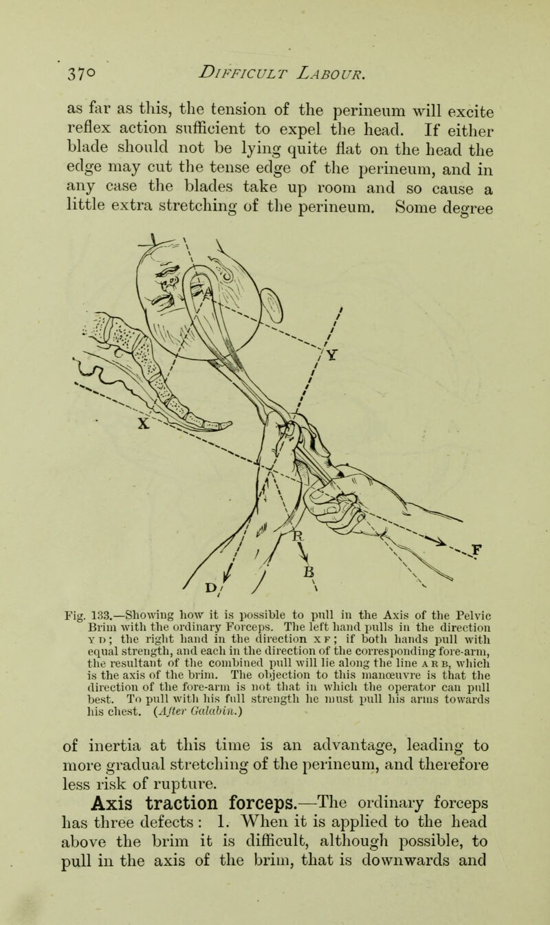 as far as this, the tension of the perineum will excite reflex action sufficient to expel the head. If either blade should not be lying quite flat on the head the edge may cut the tense edge of the perineum, and in any case the blades take up room and so cause a little extra stretching of the perineum. Some degree Fig. 133.—Showing how it is possible to pull in the Axis of the Pelvic Brim with the ordinary Forceps. The left hand pulls in the direction yd; the right hand in the direction xf; if both hands pull with equal strength, and each in the direction of the corresponding fore-arm, the resultant of the combined pull will lie along the line arb, which is the axis of the brim. The objection to this manoeuvre is that the direction of the fore-arm is not that in which the operator can pull best. To pull with his full strength he must pull his arms towards his chest. (After Galab'ui.) of inertia at this time is an advantage, leading to more gradual stretching of the perineum, and therefore less risk of rupture. Axis traction forceps.—The ordinary forceps has three defects : 1. When it is applied to the head above the brim it is difficult, although possible, to pull in the axis of the brim, that is downwards and