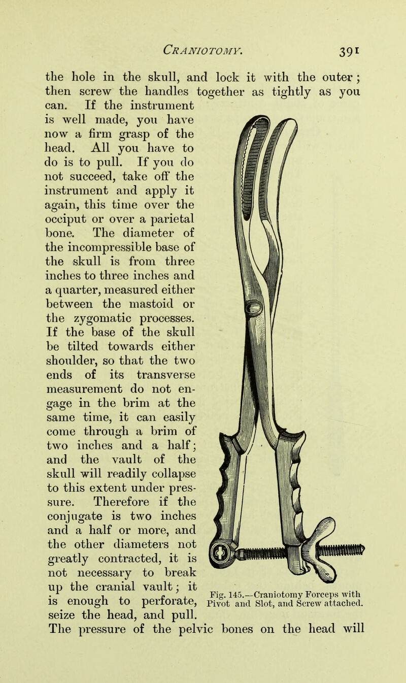 the hole in the skull, ar then screw the handles 1 can. If the instrument is well made, you have now a firm grasp of the head. All you have to do is to pull. If you do not succeed, take off the instrument and apply it again, this time over the occiput or over a parietal bone. The diameter of the incompressible base of the skull is from three inches to three inches and a quarter, measured either between the mastoid or the zygomatic processes. If the base of the skull be tilted towards either shoulder, so that the two ends of its transverse measurement do not en- gage in the brim at the same time, it can easily come through a brim of two inches and a half; and the vault of the skull will readily collapse to this extent under pres- sure. Therefore if the conjugate is two inches and a half or more, and the other diameters not greatly contracted, it is not necessary to break up the cranial vault; it is enough to perforate, seize the head, and pull. The pressure of the peb lock it with the outer; ether as tightly as you Fig. 145.—Craniotomy Forceps with Pivot and Slot, and Screw attached. ic bones on the head will