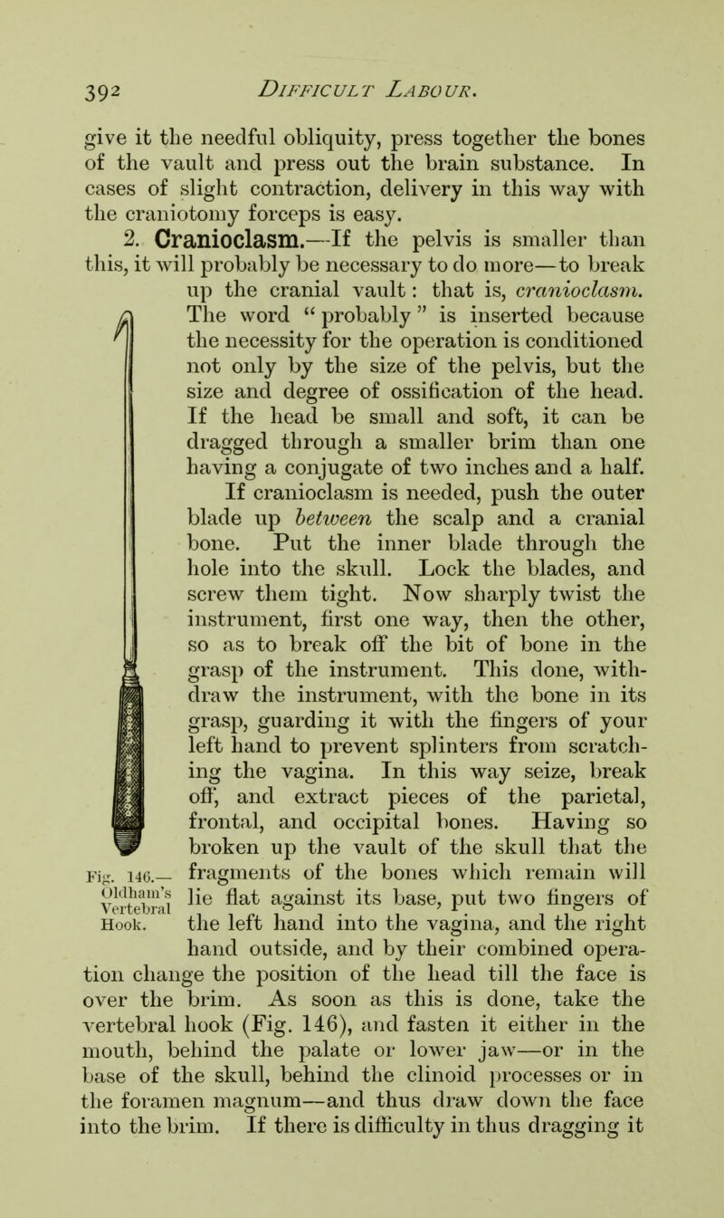 give it the needful obliquity, press together the bones of the vault and press out the brain substance. In cases of slight contraction, delivery in this way with the craniotomy forceps is easy. 2. Cranioclasm.—If the pelvis is smaller than this, it will probably be necessary to do more—to break up the cranial vault: that is, cranioclasm. The word  probably is inserted because the necessity for the operation is conditioned not only by the size of the pelvis, but the size and degree of ossification of the head. If the head be small and soft, it can be dragged through a smaller brim than one having a conjugate of two inches and a half. If cranioclasm is needed, push the outer blade up between the scalp and a cranial bone. Put the inner blade through the hole into the skull. Lock the blades, and screw them tight. Now sharply twTist the instrument, first one way, then the other, so as to break off the bit of bone in the grasp of the instrument. This done, with- draw the instrument, with the bone in its grasp, guarding it with the fingers of your left hand to prevent splinters from scratch- ing the vagina. In this way seize, break ofY, and extract pieces of the parietal, frontal, and occipital bones. Having so broken up the vault of the skull that the Fig. i4o.— fragments of the bones which remain will Vertebral ^e a&ains^ its base, put two fingers of Hook. the left hand into the vagina, and the right hand outside, and by their combined opera- tion change the position of the head till the face is over the brim. As soon as this is done, take the vertebral hook (Fig. 146), and fasten it either in the mouth, behind the palate or lower jaw—or in the base of the skull, behind the clinoid processes or in the foramen magnum—and thus draw down the face into the brim. If there is difficulty in thus dragging it