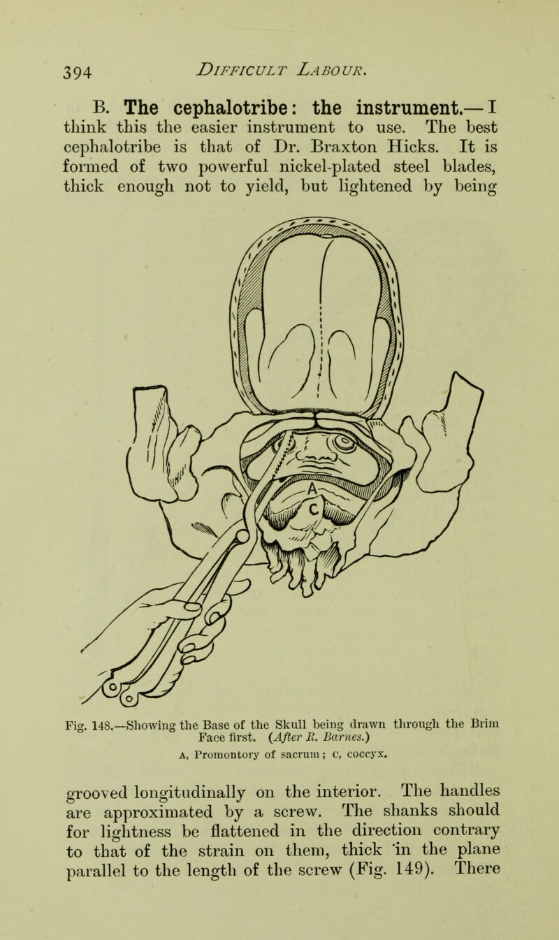 B. The cephalotribe: the instrument.—I think this the easier instrument to use. The best cephalotribe is that of Dr. Braxton Hicks. It is formed of two powerful nickel-plated steel blades, thick enough not to yield, but lightened by being Fig. 148.—Showing the Base of the Skull being drawn through the Brim Face first. {After R. Barnes.) A, Promontory of sacrum; c, coccyx. grooved longitudinally on the interior. The handles are approximated by a screw. The shanks should for lightness be flattened in the direction contrary to that of the strain on them, thick 'in the plane parallel to the length of the screw (Fig. 149). There