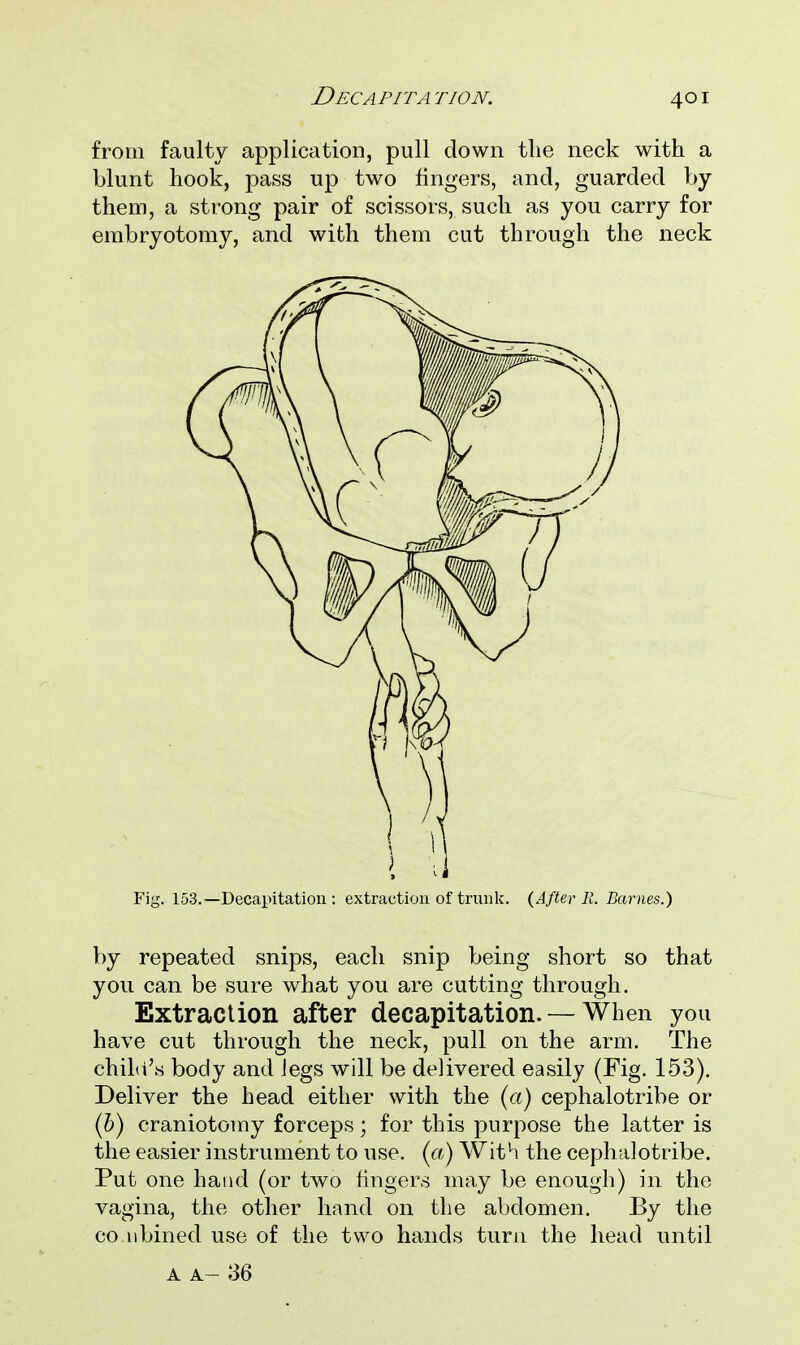 from faulty application, pull down the neck with a blunt hook, pass up two fingers, and, guarded by them, a strong pair of scissors, such as you carry for embryotomy, and with them cut through the neck Fig. 153.—Decapitation: extraction of trunk. (After 11. Barnes.) by repeated snips, each snip being short so that you can be sure what you are cutting through. Extraction after decapitation. — When you have cut through the neck, pull on the arm. The child's body and legs will be delivered easily (Fig. 153). Deliver the head either with the (a) cephalotribe or (b) craniotomy forceps; for this purpose the latter is the easier instrument to use. (a) With the cephalotribe. Put one hand (or two lingers may be enough) in the vagina, the other hand on the abdomen. By the co. 11 bined use of the two hands turn the head until A A- 36