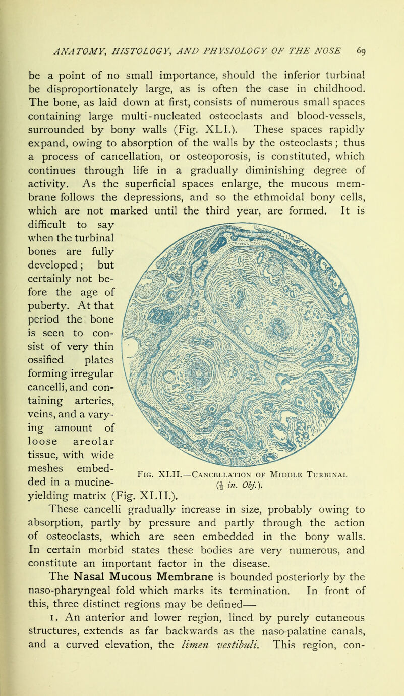 be a point of no small importance, should the inferior turbinal be disproportionately large, as is often the case in childhood. The bone, as laid down at first, consists of numerous small spaces containing large multi-nucleated osteoclasts and blood-vessels, surrounded by bony walls (Fig. XLL). These spaces rapidly expand, owing to absorption of the walls by the osteoclasts; thus a process of cancellation, or osteoporosis, is constituted, which continues through life in a gradually diminishing degree of activity. As the superficial spaces enlarge, the mucous mem- brane follows the depressions, and so the ethmoidal bony cells, which are not marked until the third year, are formed. It is difficult to say when the turbinal bones are fully developed; but certainly not be- fore the age of puberty. At that period the bone is seen to con- sist of very thin ossified plates forming irregular cancelli, and con- taining arteries, veins, and a vary- ing amount of loose areolar tissue, with wide meshes embed- ded in a mucine- yielding matrix (Fig. XLII.). These cancelli gradually increase in size, probably owing to absorption, partly by pressure and partly through the action of osteoclasts, which are seen embedded in the bony walls. In certain morbid states these bodies are very numerous, and constitute an important factor in the disease. The Nasal Mucous Membrane is bounded posteriorly by the naso-pharyngeal fold which marks its termination. In front of this, three distinct regions may be defined— I. An anterior and lower region, lined by purely cutaneous structures, extends as far backwards as the naso-palatine canals, and a curved elevation, the limen vestibuli. This region, con- FiG. XLII.—Cancellation of Middle Turbinal m. Obj\).