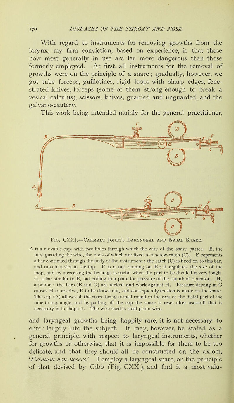 With regard to instruments for removing growths from the larynx, my firm conviction, based on experience, is that those now most generally in use are far more dangerous than those formerly employed. At first, all instruments for the removal of growths were on the principle of a snare; gradually, however, we got tube forceps, guillotines, rigid loops with sharp edges, fene- strated knives, forceps (some of them strong enough to break a vesical calculus), scissors, knives, guarded and unguarded, and the galvano-cautery. This work being intended mainly for the general practitioner. Fig. CXXI.—Carmalt Jones's Laryngeal and Nasal Snare. A is a movable cap, with two holes through which the wire of the snare passes. B, the tube guarding the wire, the ends of which are fixed to a screw-catch (C). E represents a bar continued through the body of the instrument; the catch (C) is fixed on to this bar, and runs in a slot in the top. F is a nut running on E ; it regulates the size of the loop, and by increasing the leverage is useful when the part to be divided is very tough. G, a bar similar to E, but ending in a plate for pressure of the thumb of operator. H, a pinion ; the bars (E and G) are racked and work against H. Pressure driving in G causes H to revolve, E to be drawn out, and consequently tension is made on the snare. The cap (A) allows of the snare being turned round in the axis of the distal part of the tube to any angle, and by pulling off the cap the snare is reset after use—all that is necessary is to shape it. The wire used is steel piano-wire. and laryngeal growths being happily rare, it is not necessary to enter largely into the subject. It may, however, be stated as a general principle, with respect to laryngeal instruments, whether for growths or otherwise, that it is impossible for them to be too delicate, and that they should all be constructed on the axiom, 'Primum non 7iocere! I employ a laryngeal snare, on the principle of that devised by Gibb (Fig. CXX.), and find it a most valu-