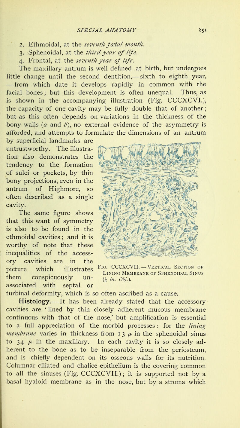 2. Ethmoidal, at the seventh fcetal month. 3. Sphenoidal, at the thh-dyea7^ of life. 4. Frontal, at the seventh year of life. The maxillary antrum is well defined at birth, but undergoes little change until the second dentition,—sixth to eighth year, —from which date it develops rapidly in common with the facial bones; but this development is often unequal. Thus, as is shown in the accompanying illustration (Fig. CCCXCVI.), the capacity of one cavity may be fully double that of another; but as this often depends on variations in the thickness of the bony walls {a and b), no external evidence of the asymmetry is afforded, and attempts to formulate the dimensions of an antrum by superficial landmarks are untrustworthy. The illustra- tion also demonstrates the tendency to the formation of sulci or pockets, by thin bony projections, even in the antrum of Highmore, so often described as a single cavity. The same figure shows that this want of symmetry is also to be found in the ethmoidal cavities ; and it is worthy of note that these inequalities of the access- ory cavities are in the picture which illustrates them conspicuously un- associated with septal or turbinal deformity, which is so often ascribed as a cause. Histology.—It has been already stated that the accessory cavities are ' lined by thin closely adherent mucous membrane continuous with that of the nose,' but amplification is essential to a full appreciation of the morbid processes: for the lining membrane varies in thickness from i 3 in the sphenoidal sinus to 34 yu, in the maxillary. In each cavity it is so closely ad- herent to the bone as to be inseparable from the periosteum, and is chiefly dependent on its osseous walls for its nutrition. Columnar ciliated and chalice epithelium is the covering common to all the sinuses (Fig. CCCXCVI I.); it is supported not by a basal hyaloid membrane as in the nose, but by a stroma which Fig. CCCXCVIL—Vertical Section of Lining Membrane of Sphenoidal Sinus in. Obj.).