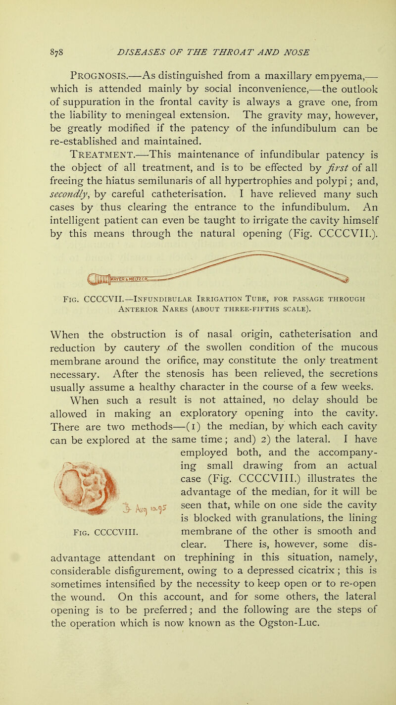 Prognosis.—As distinguished from a maxillary empyema,— which is attended mainly by social inconvenience,—the outlook of suppuration in the frontal cavity is always a grave one, from the liability to meningeal extension. The gravity may, however, be greatly modified if the patency of the infundibulum can be re-established and maintained. Treatment.—-This maintenance of infundibular patency is the object of all treatment, and is to be effected by first of all freeing the hiatus semilunaris of all hypertrophies and polypi; and, secondly, by careful catheterisation. I have relieved many such cases by thus clearing the entrance to the infundibulum. An intelligent patient can even be taught to irrigate the cavity himself by this means through the natural opening (Fig. CCCCVIL). Fig. CCCCVII.—Infundibular Irrigation Tube, for passage through Anterior Nares (about three-fifths scale). When the obstruction is of nasal origin, catheterisation and reduction by cautery .of the swollen condition of the mucous membrane around the orifice, may constitute the only treatment necessary. After the stenosis has been relieved, the secretions usually assume a healthy character in the course of a few weeks. When such a result is not attained, no delay should be allowed in making an exploratory opening into the cavity. There are two methods—(i) the median, by which each cavity can be explored at the same time; and) 2) the lateral. I have employed both,, and the accompany- ing small drawing from an actual case (Fig. CCCCVII I.) illustrates the advantage of the median, for it will be l5 seen that, while on one side the cavity is blocked with granulations, the lining Fig. CCCCVIII. membrane of the other is smooth and clear. There is, however, some dis- advantage attendant on trephining in this situation, namely, considerable disfigurement, owing to a depressed cicatrix ; this is sometimes intensified by the necessity to keep open or to re-open the wound. On this account, and for some others, the lateral opening is to be preferred; and the following are the steps of the operation which is now known as the Ogston-Luc.