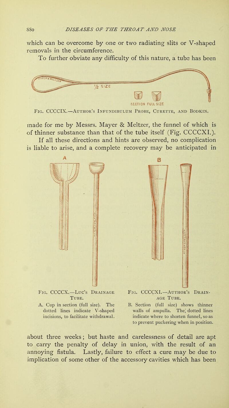 which can be overcome by one or two radiating slits or V-shaped removals in the circumference. To further obviate any difficulty of this nature, a tube has been section full size Fig. CCCCIX.—Author's Infundibulum Probe, Curette, and Bodkin. made for me by Messrs. Mayer & Meltzer, the funnel of which is of thinner substance than that of the tube itself (Fig. CCCCXI.). If all these directions and hints are observed, no complication is liable to arise, and a complete recovery may be anticipated in Li Fig. CCCCX.—Luc's Drainage Tube. A. Cup in section (full size). The dotted lines indicate V-shaped incisions, to facilitate withdrawal. Fig. CCCCXI.—Author's Drain- age Tube. B, Section (full size) shows thinner walls of ampulla. The] dotted lines indicate where to shorten funnel, so as to prevent puckering when in position. about three weeks; but haste and carelessness of detail are apt to carry the penalty of delay in union, with the result of an annoying fistula. Lastly, failure to effect a cure may be due to implication of some other of the accessory cavities which has been