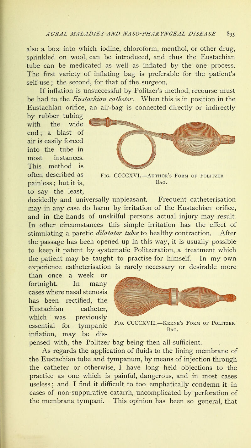 Fig. CCCCXVI.- -Author's Form of Politzer Bag. also a box into which iodine, chloroform, menthol, or other drug, sprinkled on wool, can be introduced, and thus the Eustachian tube can be medicated as well as inflated by the one process. The first variety of inflating bag is preferable for the patient's self-use ; the second, for that of the surgeon. If inflation is unsuccessful by Politzer's method, recourse must be had to the Eustachian catheter. When this is in position in the Eustachian orifice, an air-bag is connected directly or indirectly by rubber tubing with the wide end; a blast of air is easily forced into the tube in most instances. This method is often described as painless ; but it is, to say the least, decidedly and universally unpleasant. Frequent catheterisation may in any case do harm by irritation of the Eustachian orifice, and in the hands of unskilful persons actual injury may result In other circumstances this simple irritation has the effect of stimulating a paretic dilatator tubce to healthy contraction. After the passage has been opened up in this way, it is usually possible to keep it patent by systematic Politzeration, a treatment which the patient may be taught to practise for himself. In my own experience catheterisation is rarely necessary or desirable more than once a week or fortnight. In many cases where nasal stenosis has been rectified, the Eustachian catheter, which was previously essential for tympanic inflation, may be dis- pensed with, the Politzer bag being then all-sufficient. As regards the application of fluids to the lining membrane of the Eustachian tube and tympanum, by means of injection through the catheter or otherwise, I have long held objections to the practice as one which is painful, dangerous, and in most cases useless; and I find it difficult to too emphatically condemn it in cases of non-suppurative catarrh, uncomplicated by perforation of the membrana tympani. This opinion has been so general, that Fig. CCCCXVII.—Keene's Form of Politzer Bag.