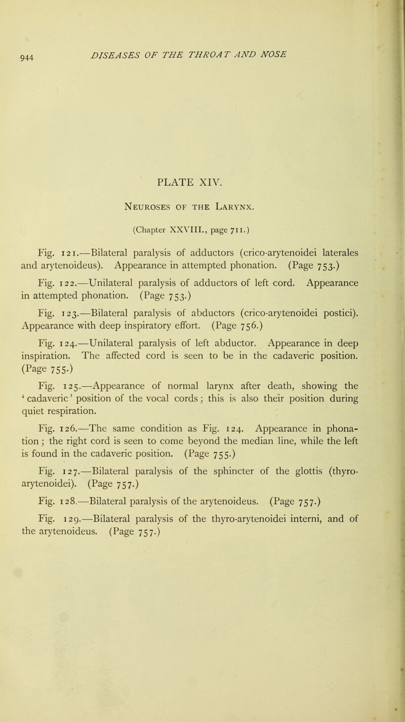 PLATE XIV. Neuroses of the Larynx. (Chapter XXVIII., page 711.) Fig. 121.—Bilateral paralysis of adductors (crico-arytenoidei laterales and arytenoideus). Appearance in attempted phonation. (Page 753.) Fig. 122.—Unilateral paralysis of adductors of left cord. Appearance in attempted phonation. (Page 753.) Fig. 123.—Bilateral paralysis of abductors (crico-arytenoidei postici). Appearance with deep inspiratory effort. (Page 756.) Fig. 124.—Unilateral paralysis of left abductor. Appearance in deep inspiration. The affected cord is seen to be in the cadaveric position. (Page 755.) Fig. 125.—Appearance of normal larynx after death, showing the ' cadaveric' position of the vocal cords; this is also their position during quiet respiration. Fig. 126.—The same condition as Fig. 124. Appearance in phona- tion ; the right cord is seen to come beyond the median line, while the left is found in the cadaveric position. (Page 755.) Fig. 127.—Bilateral paralysis of the sphincter of the glottis (thyro- arytenoidei). (Page 757.) Fig. 128.—Bilateral paralysis of the arytenoideus. (Page 757.) Fig. 129.—Bilateral paralysis of the thyro-arytenoidei interni, and of the arytenoideus. (Page 757.)