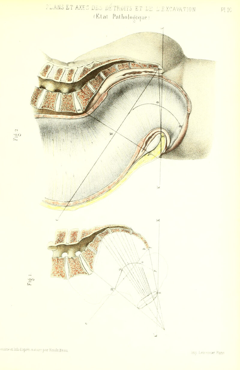 .ANS ET AIE:^ D£,:. Uii:TB.UlTS ET LE ( Kl al Pal h f)| (Mil nue ) XCAVATION PI 10 I PF,5inf etlitlidaprèo naujr.-par KrinleJjecUL