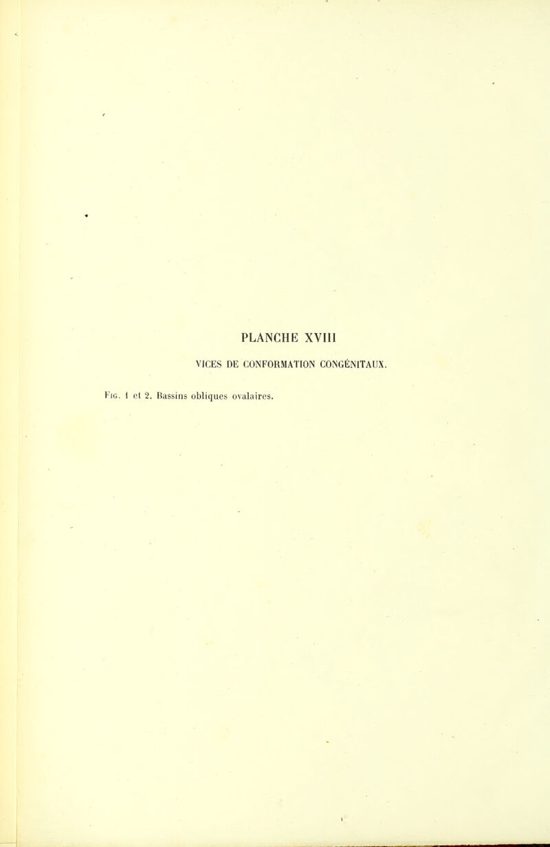 PLANCHE XVIII VICES DE CONFORMATION CONGÉNITAUX. FiG. 1 et 2. Bassins obliques ovalaires.