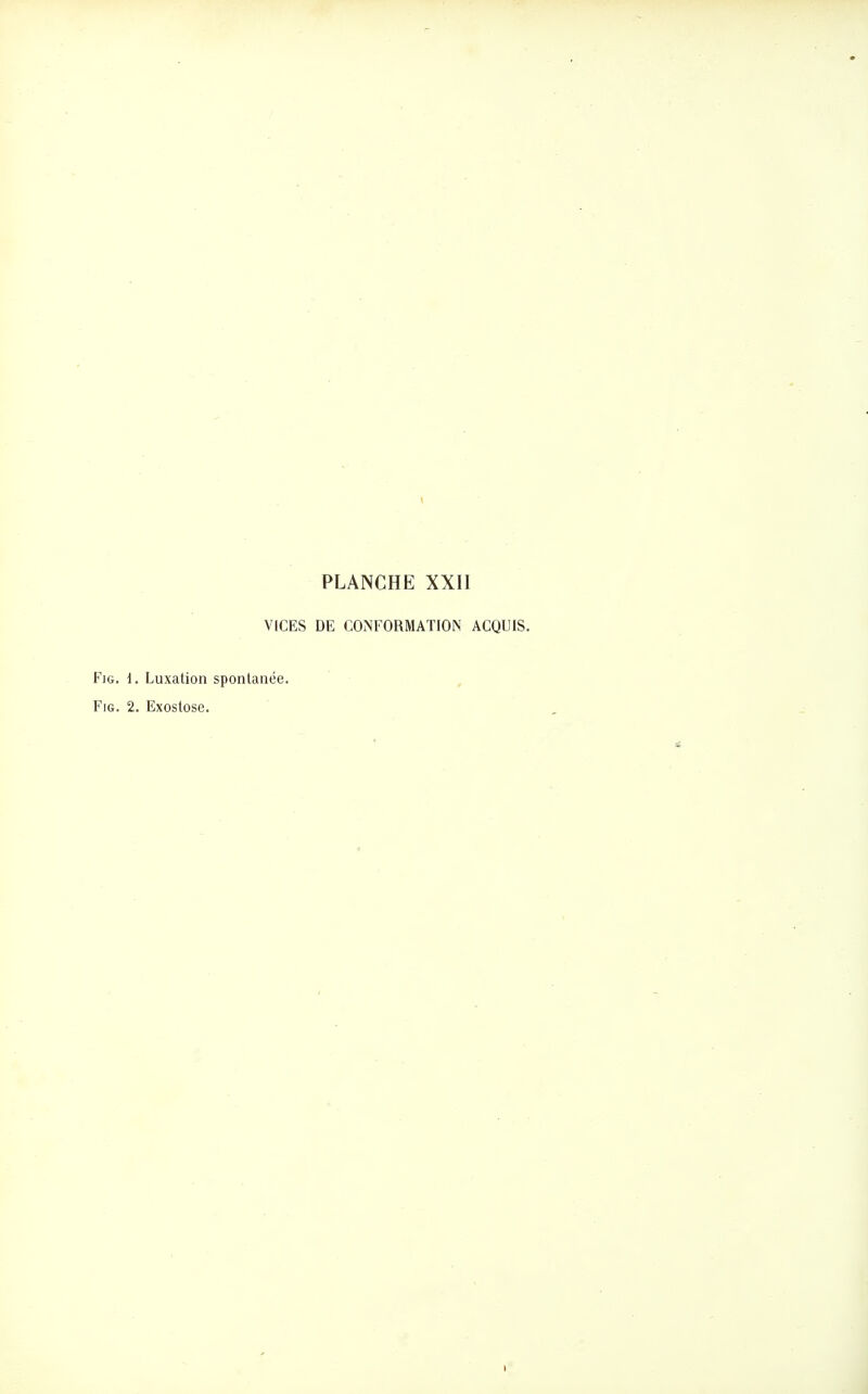 VICES DE COiNFORMATION ACQUIS. FiG. \. Luxation spontanée. FiG. 2. Exostose.