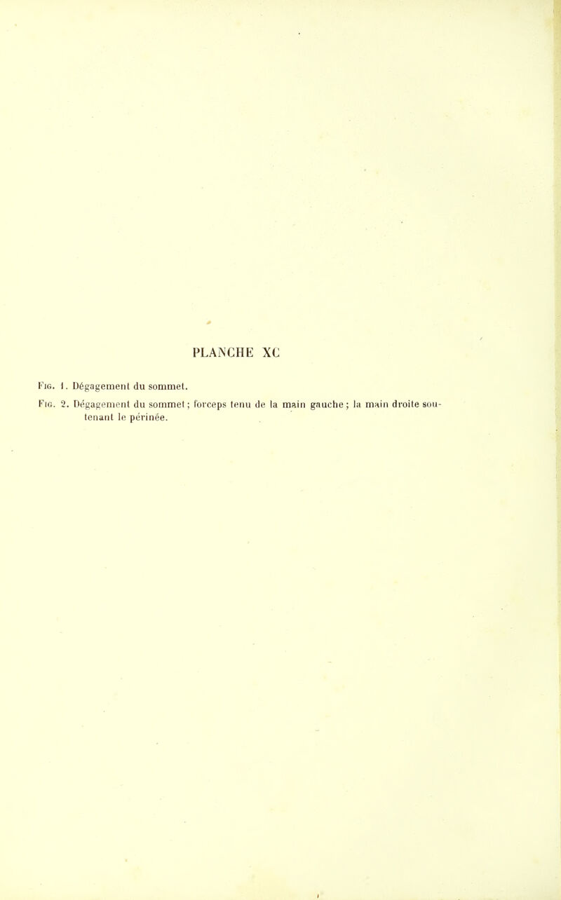 KiG. \. Dégagement du sommet. FiG. 2. Dégagement du sommet ; forceps tenu de la main gauche ; la mnin droite sou- tenant le périnée.