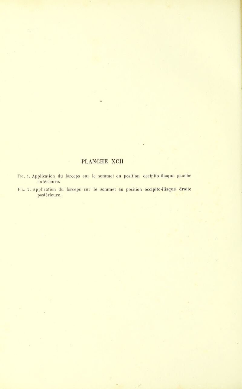 FiG. î. ApplicalioQ du forceps sur le sommet en position occipito-iliaque gauche antérieure. FiG. 2. Application du forceps sur le sommet en position occipito-iliaque droite postérieure.