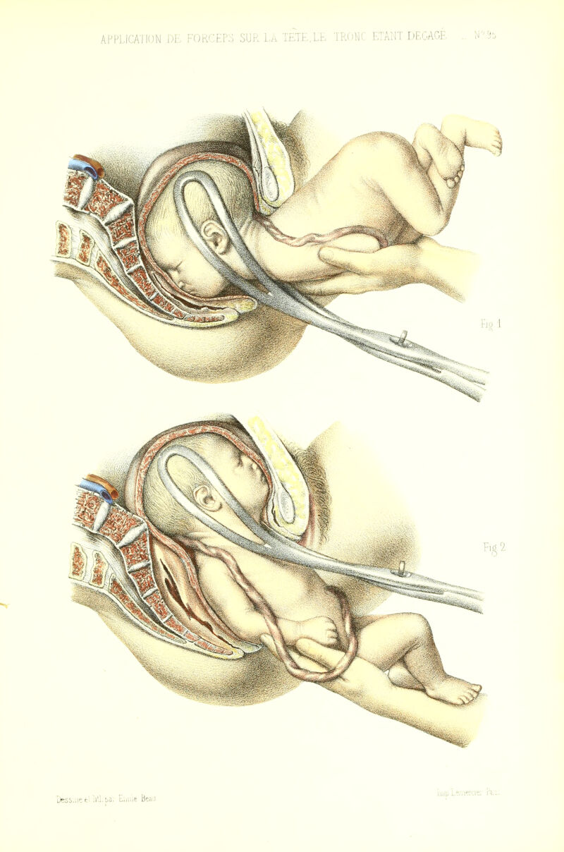 Dess.'.iet^ ii'lta. u.-„uit beaJ i])ip L?)Tiercie:-