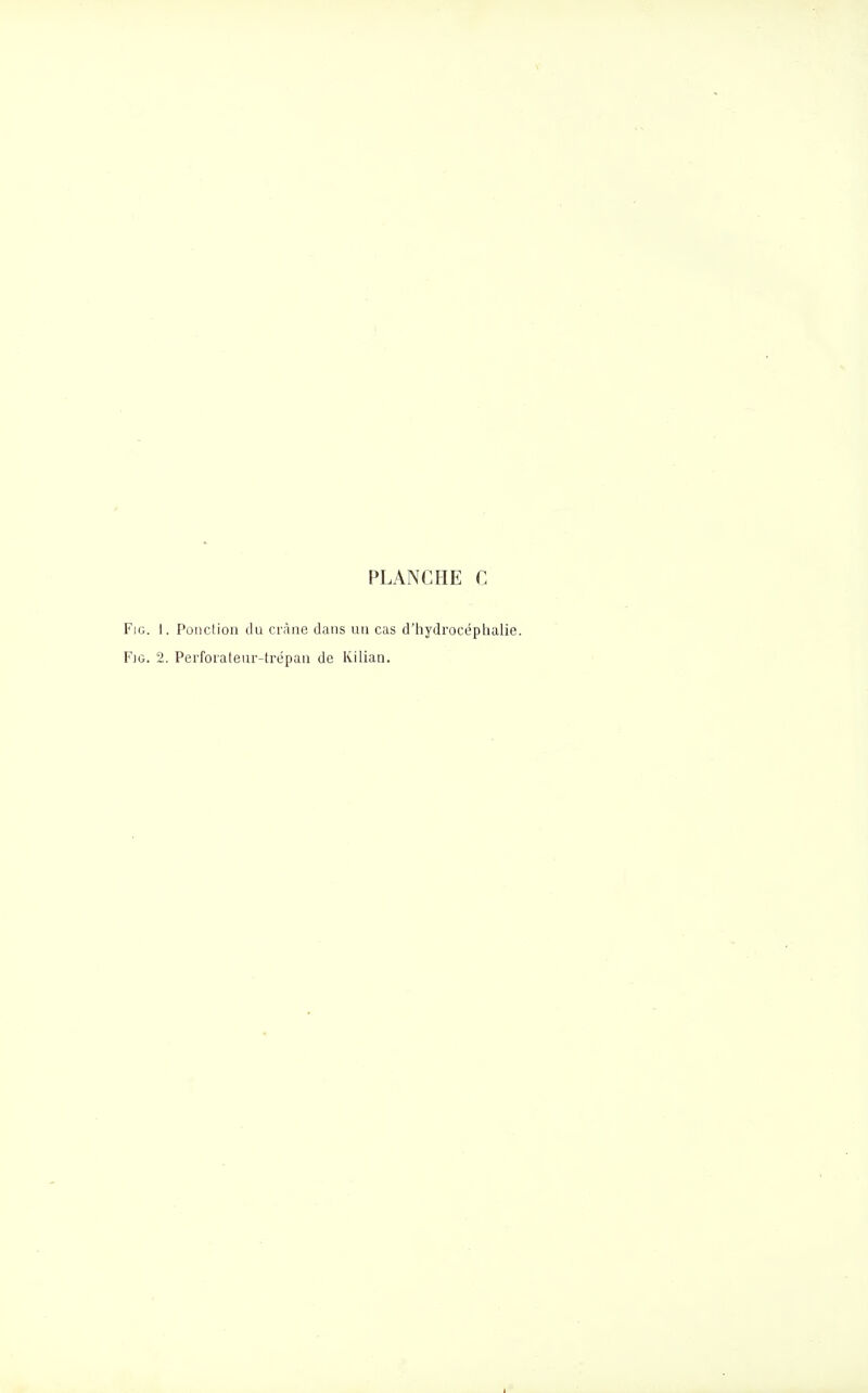 Fie. I. Pûiiclioii du ci'àne dans un cas d'hydrocéphalie. F]G. 2. Perfoiateur-trcpaii de Kilian.