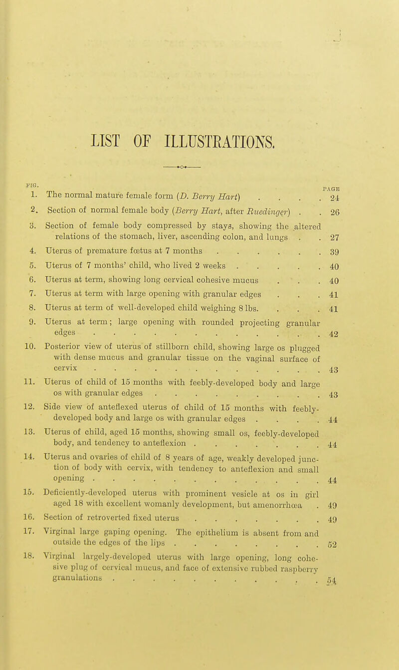 LIST OF ILLUSTEATIONS. 1. The normal mature female form (D. Bcrrij Hart) . . . . 2-4 2. Section of normal female body {Berry Hart, after Bziedinger) . . 26 o. Section of female body compressed by stays, showing the altered relations of the stomach, liver, ascending colon, and lungs . . 27 4. Uterus of premature foetus at 7 months 5. Uterus of 7 months' child, who lived 2 weeks 6. Uterus at term, showing long cervical cohesive mucus 7. Uterus at term with large opening with granular edges 8. Uterus at term of well-developed child weighing 8 lbs. 9. Uterus at term; large opening with rounded projecting granular edges 39 40 40 41 41 42 10. Posterior view of uterus of stillborn child, showing large os plugged with dense mucus and granular tissue on the vaginal surface of cervix 43 11. Uterus of child of 15 months with feebly-developed body and large OS with granular edges 43 12. Side view of anteflexed uterus of child of 15 months with feebly- developed body and large os with granular edges . . . .44 13. Uterus of child, aged 15 months, showing small os, feebly-developed body, and tendency to anteflexion ....... 44 14. Uterus and ovaries of child of 8 years of age, weakly developed junc- tion of body with cervix, with tendency to anteflexion and small opening 44 15. Deficiently-developed uterus with prominent vesicle at os in girl aged 18 with excellent womanly development, but amenorrhoea . 49 16. Section of retroverted fixed uterus 49 17. Virginal large gaping opening. The epithelium is absent from and outside the edges of the lips 52 18. Virginal largely-developed uterus with largo opening, long cohe- sive plug of cervical nnicus, and face of extensive rubbed raspberry granulations