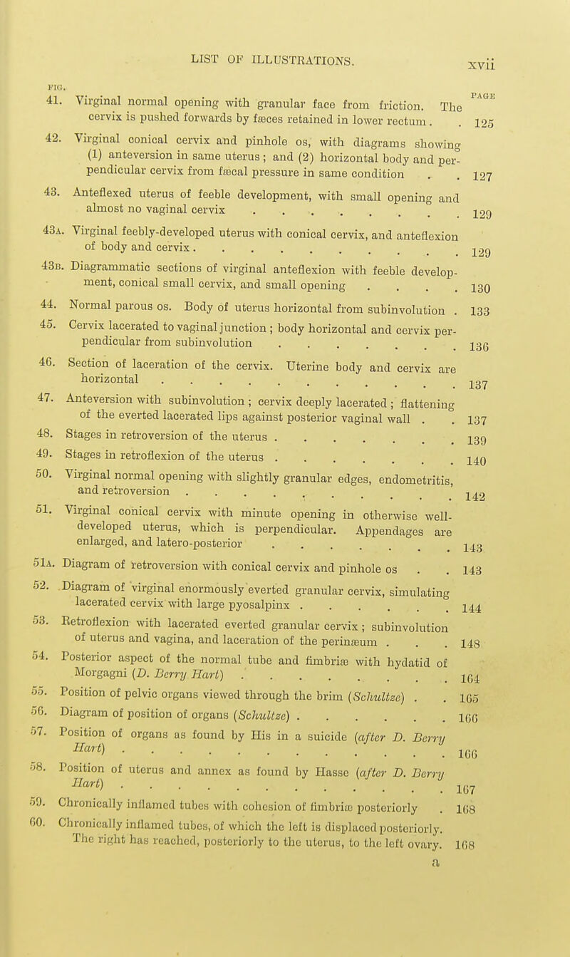 41. Virginal normal opening with granular face from friction. The cervix is pushed forwards by fajces retained in lower rectum. .125 42. Virginal conical cervix and pinhole os, with diagrams showing (1) anteversion in same uterus ; and (2) horizontal body and per pendicular cervix from fscal pressure in same condition . .127 43. Anteflexed uterus of feeble development, with small opening and almost no vaginal cervix . 43a. Virginal feebly-developed uterus with conical cervix, and anteflexion of body and cervix j.^g 43b. Diagrammatic sections of virginal anteflexion with feeble develop- ment, conical small cervix, and small opening .... 130 44. Normal parous os. Body of uterus horizontal from subinvolution . 133 45. Cervix lacerated to vaginal junction ; body horizontal and cervix per- pendicular from subinvolution j3q 46. Section of laceration of the cervix. Uterine body and cervix are horizontal -j^gy 47. Anteversion with subinvolution ; cervix deeply lacerated ; flattening of the everted lacerated lips against posterior vaginal wall . . 137 48. Stages in retroversion of the uterus 13g 49. Stages in retroflexion of the uterus 14q 50. Virginal normal opening with slightly granular edges, endometritis, and retroversion I49 51. Virginal conical cervix with minute opening in otherwise well- developed uterus, which is perpendicular. Appendages are enlarged, and latero-posterior olA. Diagram of retroversion with conical cervix and pinhole os . . 143 52. Diagram of 'virginal enormously everted granular cervix, simulating lacerated cervix with large pyosaljiinx I44 53. Ketroflexion with lacerated everted granular cervix; subinvolution of uterus and vagina, and laceration of the perina3um . . .148 54. Posterior aspect of the normal tube and fimbrioB with hydatid of Morgagni (Z>. Berry Hart) 104 55. Position of pelvic organs viewed through the brim (Schultzc) . , 165 06. Diagram of position of organs {Schultzc) 160 57. Position of organs as found by His in a suicide [after D. Berry ^«'^) 166 58. Position of uterus and annex as found by Hassc {after D. Barry ■^^^^/) 107 59. Chronically inflamed tubes with cohesion of flmbrim posteriorly . 108 00. Cln-onically inflamed tubes, of which the left is displaced posteriorly. The right has reached, posteriorly to the uterus, to the left ovary. 108