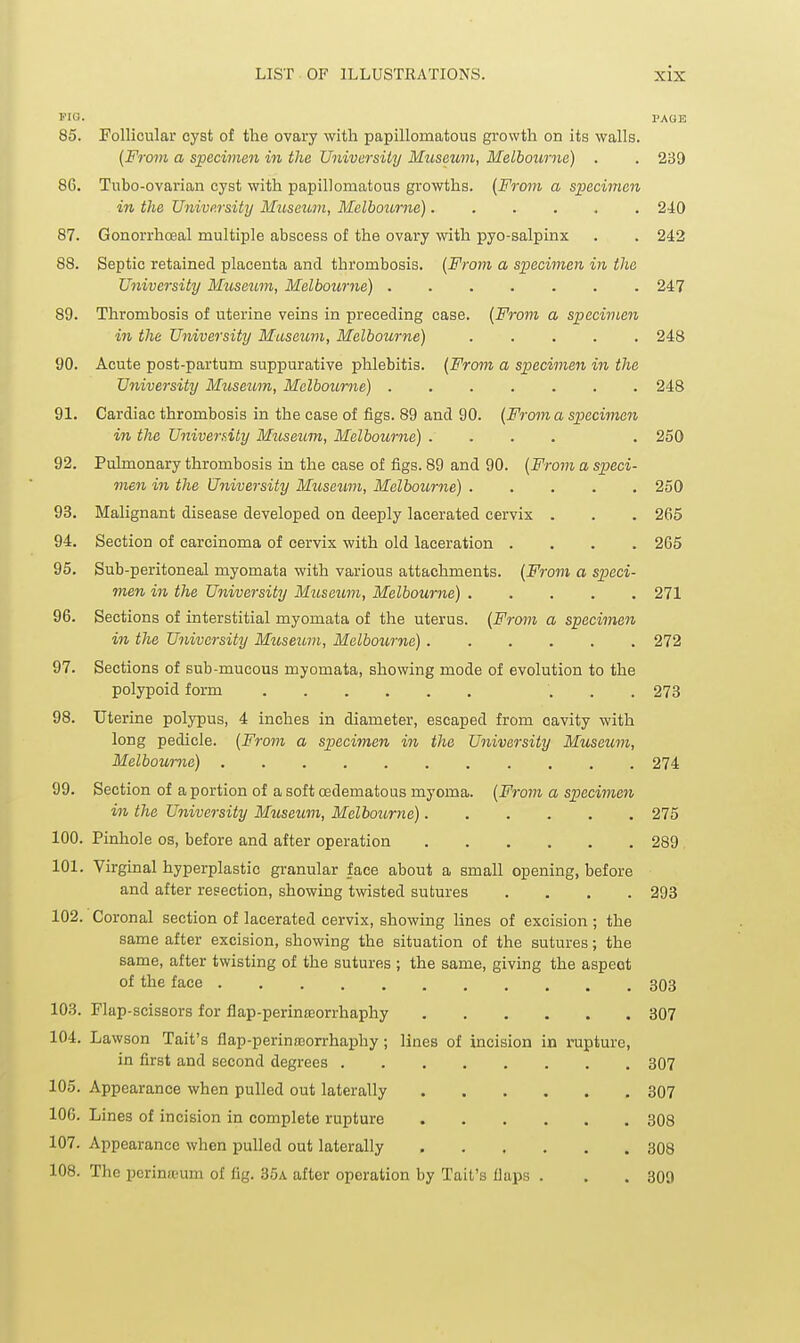 PIO. PAGE 85. Follicular cyst of the ovary with papillomatous growth on its walls. (From a specimen in tlia Universily Museum, Melbourne) . . 239 86. Tubo-ovarian cyst with papillomatous growths. {From a specimen in the University Museum, Melbourne) 240 87. Gonorrhoeal multiple abscess of the ovary with pyo-salpinx . . 242 88. Septic retained placenta and thrombosis. {From a specimen in the University Museum, Melbourne) 247 89. Thrombosis of uterine veins in preceding case. {From a specimen in the University Museum, Melbourne) 248 90. Acute post-partum suppurative phlebitis. {From a specimen in the University Museum, Melbourne) ....... 248 91. Cardiac thrombosis in the case of figs. 89 and 90. {From a specimen in the University Museum, Melbourne) .... . 250 92. Pulmonary thrombosis in the case of figs. 89 and 90. {From a speci- men in the University Museum, Melbourne) 250 93. Malignant disease developed on deeply lacerated cervix . . . 265 94. Section of carcinoma of cervix with old laceration .... 265 95. Sub-peritoneal myomata with various attachments. {From a speci- men in the University Museum, Melbourne) 271 96. Sections of interstitial myomata of the uterus. {From a specimen in the University Museum, Melboii,rne) 272 97. Sections of sub-mucous myomata, showing mode of evolution to the polypoid form ... 273 98. Uterine polypus, 4 inches in diameter, escaped from cavity with long pedicle. {From a specimen in the University Museum, Melbourne) 274 99. Section of a portion of a soft oedematous myoma. {From a specimen in the University Museum, Melbo^lrne) 275 100. Pinhole os, before and after operation 289 101. Virginal hyperplastic granular face about a small opening, before and after resection, showing twisted sutures .... 293 102. Coronal section of lacerated cervix, showing lines of excision ; the same after excision, showing the situation of the sutures; the same, after twisting of the sutures ; the same, giving the aspect of the face 303 103. Flap-scissors for flap-perin!Eorrhaphy 307 104. Lawson Tait's flap-perinmorrhaphy; lines of iacision in rapture, in first and second degrees 307 105. Appearance when pulled out laterally 307 106. Lines of incision in complete rupture 308 107. Appearance when pulled out laterally 308 108. The pcrinaeum of fig. 35a after operation by Tait's llaps . . . 309