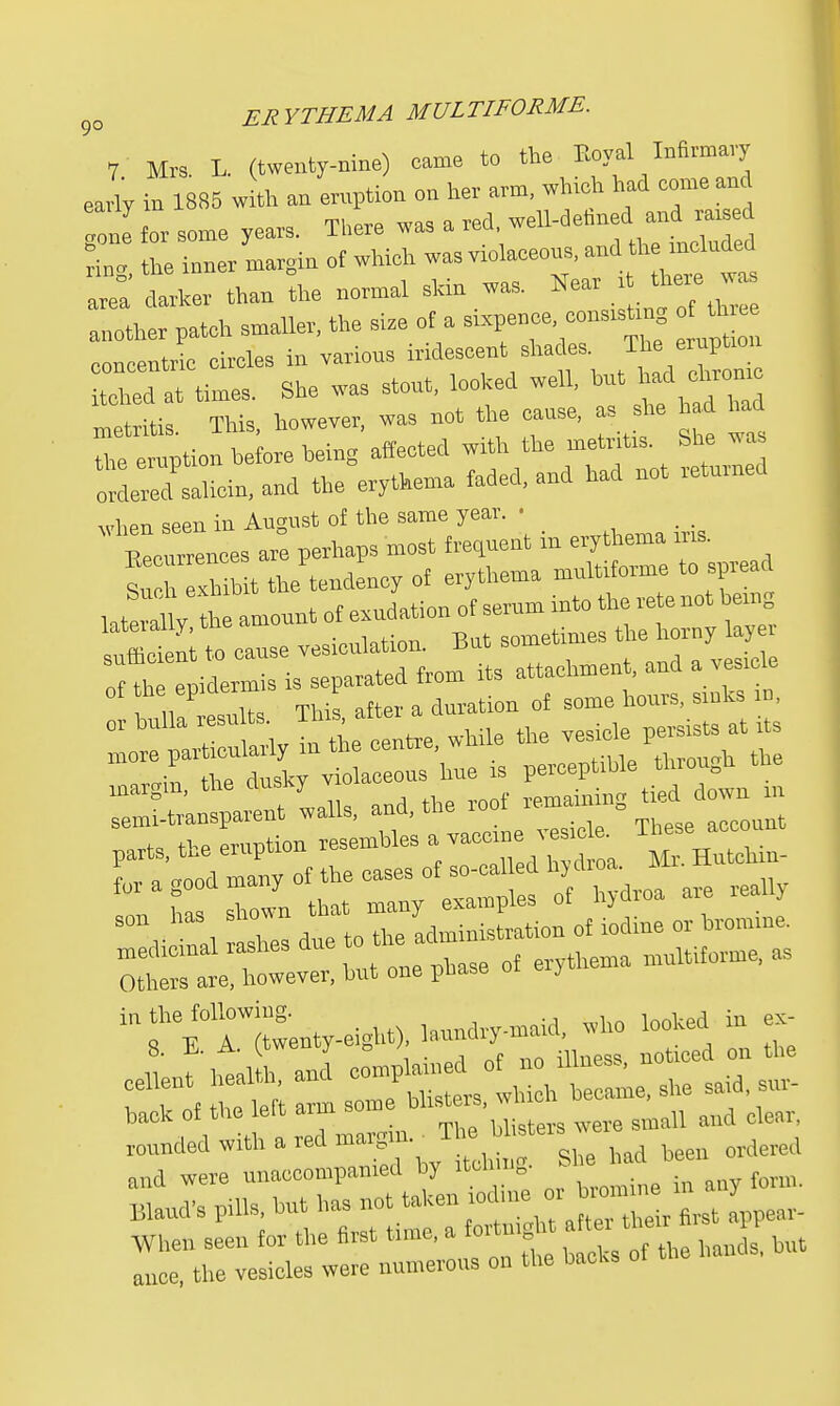 7 Mrs. L. (twenty-mne) came to the Boyal Infirmary early in 1885 with an eruption on her arm, which had come and ml for some years. There was a ' Lg, the inner margin of which — eons h ^ude. area darker than the normal shin was. Meal * .another patch smaller, the size of a sixpence, consists o th e concentric circles in various iridescent shades. The eruption tcheTat times. She was stout, looked well, but had chrome Sis. This, however, was not the cause, as she ha had the eruption before being affected with the metritis. She wa orLXliein.and the erythema faded, and had not returned when seen in August of the same year. • Crrenees are perhaps most frequent in erythema iris. STxh nit the tendency of erythema multiforme to spread JSr to amount of exudation of serum into the rete not being Sit cause vesiculate. But sometimes the horny layer ££t£STi. separated from its attachment, and a vesicle of the epmeim y ^ ^ ^ smks 1Di orhnllaresu . Thi, aftei a persists at it, ~r dl — 'hue is perceptible through the reXnspareut walls, and, the roof remaining tied down m parts, the eruption resembles a vancme vesrd . ^u- ashes due to the administration of iodine or bromine, ^ver, but one phase of erythema multiforme, as taferr^enty-eignt), laundry-maid who looked in ex- rounded with a red margin. J m b ters ^ and were unaccompanied by Itching. Bland's pills, but has not taken .«in, « ™^ » ? When seen for the first time, a fctmght tm the PP ^ ance, the vesicles were numerous on the backs