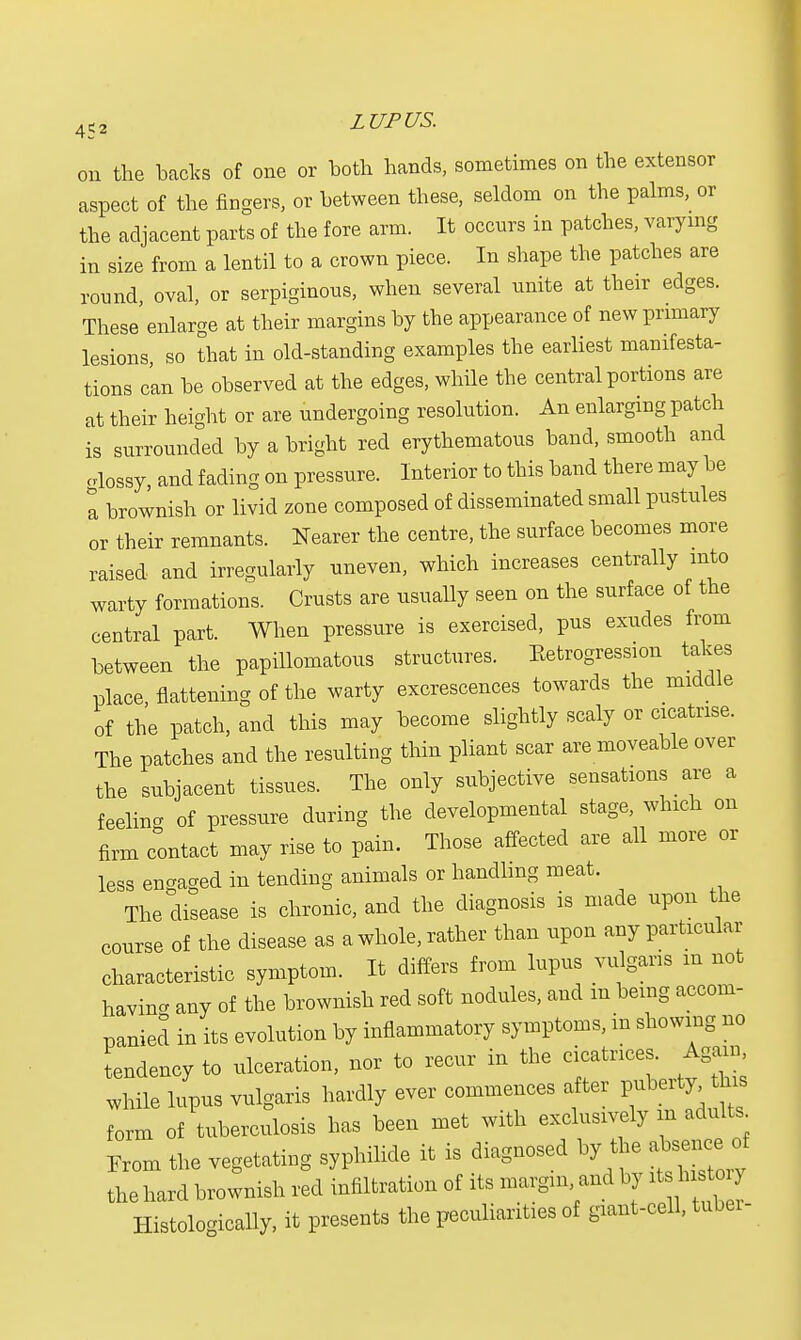 on the backs of one or both hands, sometimes on the extensor aspect of the fingers, or between these, seldom on the palms, or the adjacent parts of the fore arm. It occurs in patches, varying in size from a lentil to a crown piece. In shape the patches are round, oval, or serpiginous, when several unite at their edges. These enlarge at their margins by the appearance of new primary lesions so that in old-standing examples the earliest manifesta- tions can be observed at the edges, while the central portions are at their height or are undergoing resolution. An enlarging patch is surrounded by a bright red erythematous band, smooth and .lossy, and fading on pressure. Interior to this band there may be I brownish or livid zone composed of disseminated small pustules or their remnants. Nearer the centre, the surface becomes more raised and irregularly uneven, which increases centrally into warty formations. Crusts are usually seen on the surface of the central part. When pressure is exercised, pus exudes from between the papillomatous structures. Ketrogression takes place, flattening of the warty excrescences towards the middle of the patch, and this may become slightly scaly or cicatrise. The patches and the resulting thin pliant scar are moveable over the subjacent tissues. The only subjective sensations are a feeling of pressure during the developmental stage, which on firm contact may rise to pain. Those affected are all more or less engaged in tending animals or handling meat. The disease is chronic, and the diagnosis is made upon the course of the disease as a whole, rather than upon any particular characteristic symptom. It differs from lupus vulgaris in not bavin* any of the brownish red soft nodules, and m being accom- panied in its evolution by inflammatory symptoms, in showing no tendency to ulceration, nor to recur in the cicatrices. Again while lupus vulgaris hardly ever commences after F*f*^ form of tuberculosis has been met with exclusively m adults From the vegetating syphilide it is diagnosed by the absence^ the hard brownish red infiltration of its margin and by it h to Histologically, it presents the peculiarities of giant-cell, tuber-