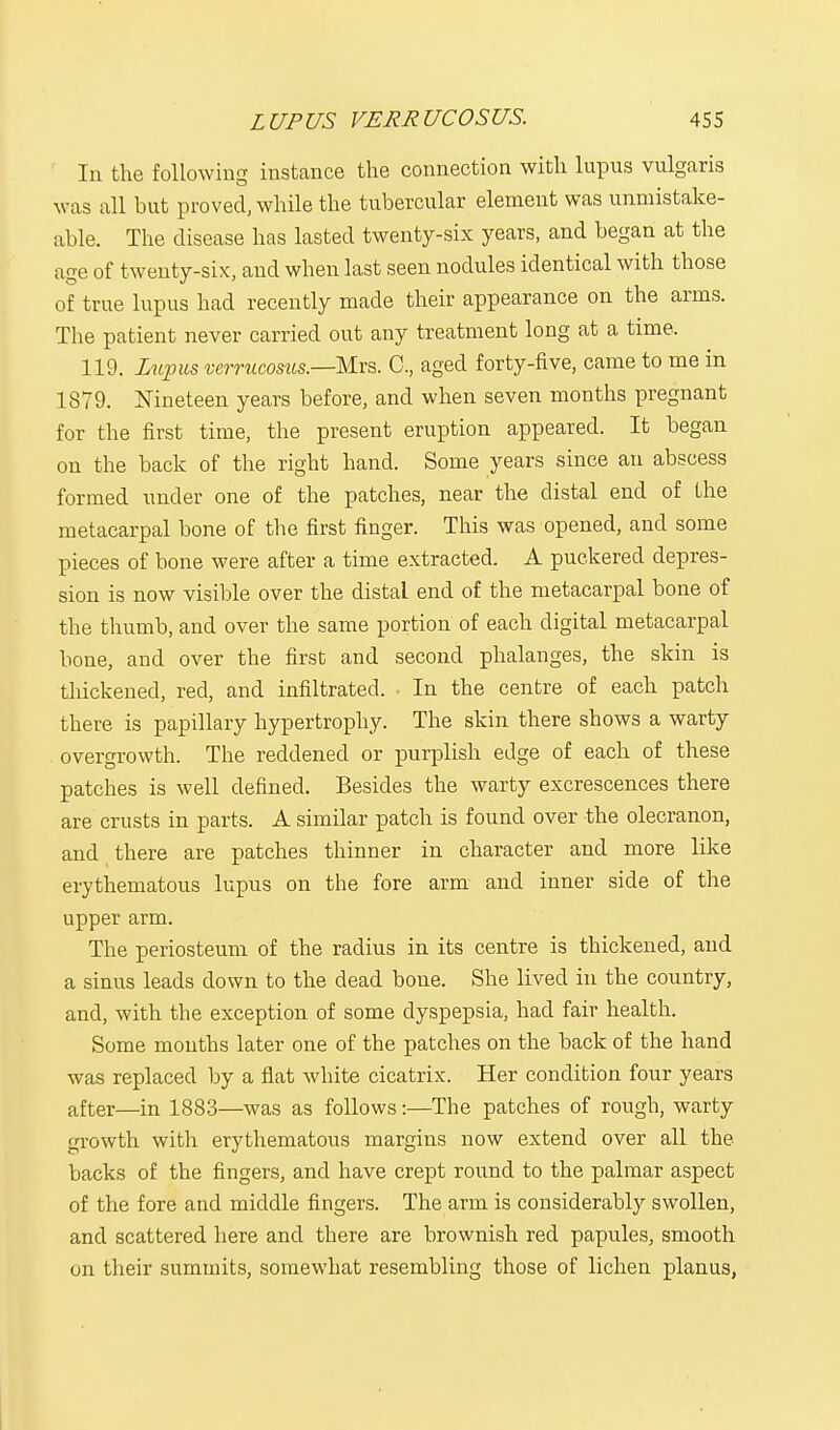 In the following instance the connection with lupns vulgaris was all but proved, while the tubercular element was unmistake- able. The disease has lasted twenty-six years, and began at the age of t wenty-six, and when last seen nodules identical with those of true lupus had recently made their appearance on the arms. The patient never carried out any treatment long at a time. 119. Lupus verrucosus.—Mxs. C, aged forty-five, came to me in 1879. Nineteen years before, and when seven months pregnant for the first time, the present eruption appeared. It began on the back of the right hand. Some years since an abscess formed under one of the patches, near the distal end of the metacarpal bone of the first finger. This was opened, and some pieces of bone were after a time extracted. A puckered depres- sion is now visible over the distal end of the metacarpal bone of the thumb, and over the same portion of each digital metacarpal bone, and over the first and second phalanges, the skin is thickened, red, and infiltrated. In the centre of each patch there is papillary hypertrophy. The skin there shows a warty overgrowth. The reddened or purplish edge of each of these patches is well defined. Besides the warty excrescences there are crusts in parts. A similar patch is found over the olecranon, and there are patches thinner in character and more like erythematous lupus on the fore arm and inner side of the upper arm. The periosteum of the radius in its centre is thickened, and a sinus leads down to the dead bone. She lived in the country, and, with the exception of some dyspepsia, had fair health. Some months later one of the patches on the back of the hand was replaced by a flat white cicatrix. Her condition four years after—in 1883—was as follows:—The patches of rough, warty growth with erythematous margins now extend over all the backs of the fingers, and have crept round to the palmar aspect of the fore and middle fingers. The arm is considerably swollen, and scattered here and there are brownish red papules, smooth on their summits, somewhat resembling those of lichen planus,