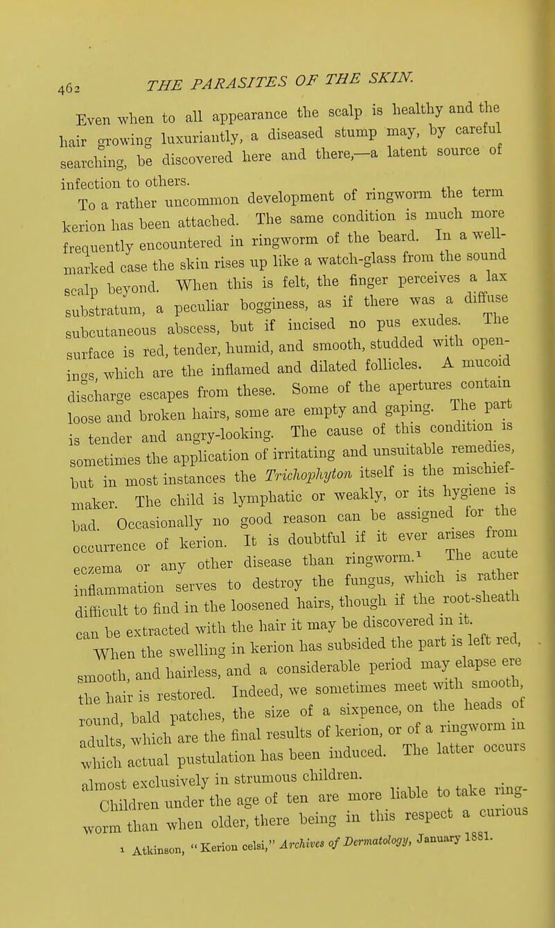 Even when to all appearance the scalp is healthy and the hair growing luxuriantly, a diseased stump may, hy carefu searching, he discovered here and there,-a latent sonrce of infection to others. To a rather uncommon development of ringworm the term kerion has been attached. The same condition is much more frequently encountered in ringworm of the beard. In a well- marked case the skin rises up like a watch-glass from the sound scalp beyond. When this is felt, the finger perceives a lax substratum, a peculiar bogginess, as if there was a Effuse snbcutaneous abscess, but if incised no pus exudes The surface is red, tender, humid, and smooth, studded with open- ings which are the inflamed and dilated follicles. A mucoid discharge escapes from these. Some of the apertures^contain loose and broken hairs, some are empty and gaping. The part is tender and angry-looking. The cause of this condition is sometimes the application of irritating and unsuitable remedies, but in most instances the Trichophyton itself is the mischief- maker. The child is lymphatic or weakly, or its hygiene is bad Occasionally no good reason can be assigned for the occurrence of kerion. It is doubtful if it ever arises from eczema or any other disease than ringworm. ^ rather inflammation serves to destroy the fungus, which is rathe difficult to find in the loosened hairs, though if the roo -sheath can be extracted with the hair it may be discovered m it When the swelling in kerion has subsided the part is left red, smooth, and hairless, and a considerable period may elapse. ere 2 hai is restored. Indeed, we sometimes meet with smooth ound bald patches, the size of a sixpence, on the heads of adults which are the final results of kerion, or of a ringworm in S actual pustulation has been induced. The latter occurs almost exclusively in strumous children. Children under the age of ten are more liable to take nng WOrmtan when older, there being in this respect a curious i Atkinson, « Kerion oelsi, Archive* of Dermatology, January 1881.