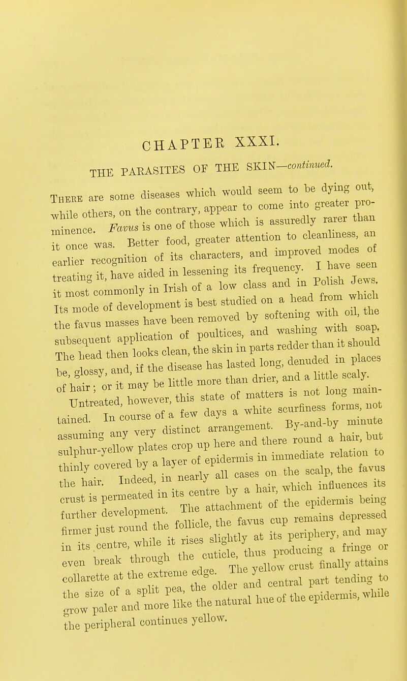 CHAPTER XXXI. THE PARASITES OF THE SKW-continued. There are some diseases which would seem to he dying out, Vle otl ers on the contrary, appear to come into greater pro- T fZus is one of Le which is assuredly rarer than m e. H Eptter food greater attention to cleanhness, an * ler^ recognition of its characters, and improved modes of iSLTh^ded in lessening its fluency. I have seen treating it, ^ .q pohsh JewSt ° however, to state of matters is not bug »»• Untreateo, no , scurfl„ess forms, not tained. In course of a few days a w fc inute assuming any very distinct —but Bnlptar-yellow plates Mediate relation to the hair. Indeed, in nearly influeIices its erust is permeated in 1 epidermis being farther development T attoc. — firmer just round *e Mbde the and may ta ^.^^^ iL/thus prodncing a fringe or even break through u attams collarette at the extreme rfg* The 7*1- ^ t0 the size of a split pea, the older on epidermis, while grew paler and more like the natural hue of the epic, the peripheral continues yellow.