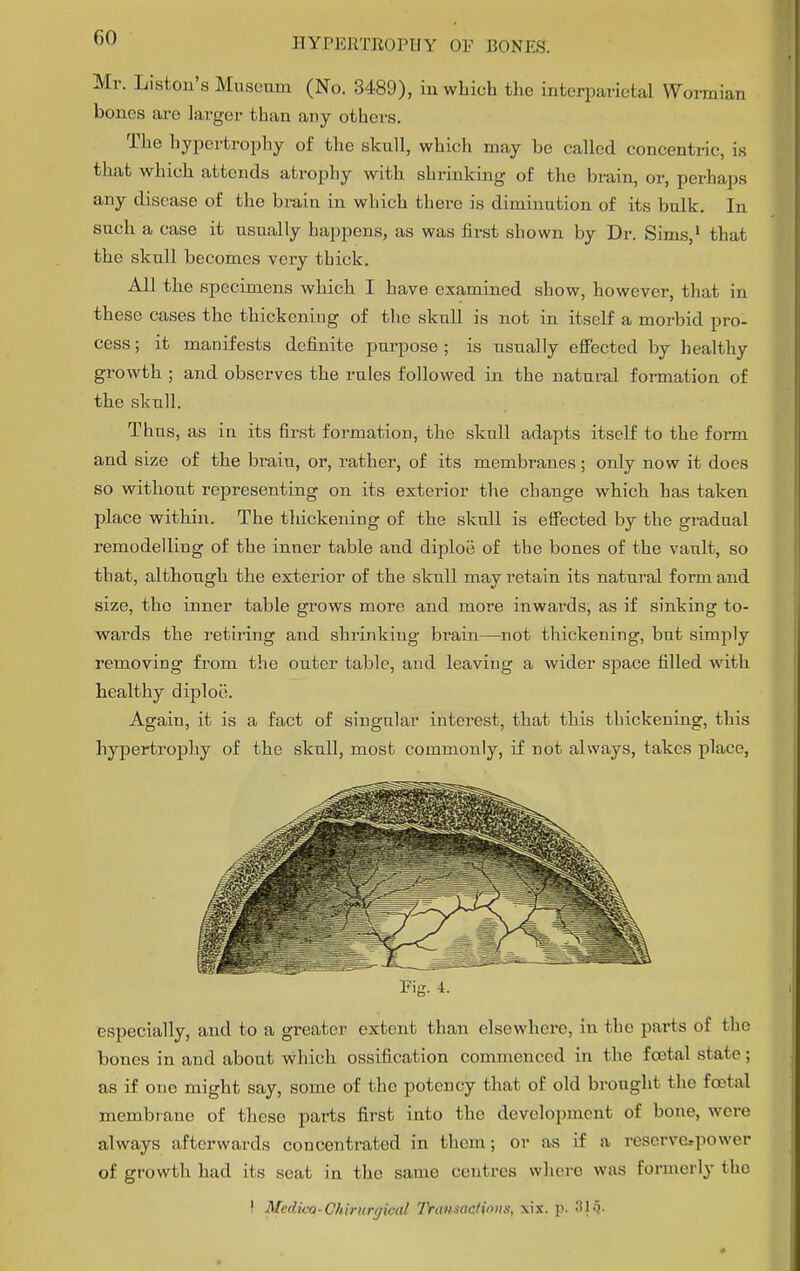 °u HYPERTEOPHY OF BONEiSf. Mr. List on's Museum (No. 3489), in which the interparietal Wormian bones are larger than any others. The hypertrophy of the skull, which may be called concentric, is that which attends atrophy with shrinking of the brain, or, perhaps any disease of the brain in which there is diminution of its bulk. In such a case it usually happens, as was first shown by Dr. Sims,1 that the skull becomes very thick. All the specimens which I have examined show, however, that in these cases the thickening of the skull is not in itself a morbid pro- cess ; it manifests definite purpose ; is usually effected by healthy growth ; and observes the rules followed in the natural formation of the skull. Thus, as in its first formation, the skull adapts itself to the form and size of the brain, or, rather, of its membranes; only now it does so without representing on its exterior the change which has taken place within. The thickening of the skull is effected by the gradual remodelling of the inner table and diploe of the bones of the vault, so that, although the exterior of the skull may retain its natural form and size, the inner table grows more and more inwards, as if sinking to- wards the retiring and shrinking brain—not thickening, but simply removing from the outer table, and leaving a wider space filled with healthy diploe. Again, it is a fact of singular interest, that this thickening, this hypertrophy of the skull, most commonly, if not always, takes place, Pig. 4. especially, and to a greater extent than elsewhere, in the parts of the bones in and about which ossification commenced in the foetal state; as if one might say, some of the potency that of old brought the foetal membiane of these parts first iuto the development of bone, were always afterwards concentrated in them; or as if a reserve»power of growth had its seat in the same centres where was formerly the } Medico-Chirurtjicat DransacHons, xix. p. 81§.