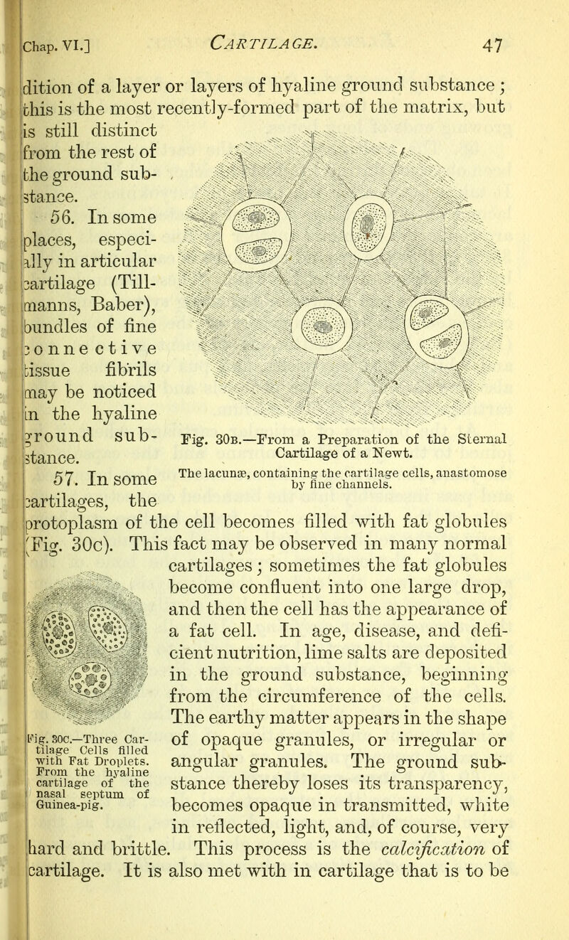 rig. 30b.- dition of a layer or layers of hyaline ground substance ; fchis is the most recently-formed part of the matrix, but is still distinct from the rest of >' the ground sub- stance. 56. In some places, especi- ally in articular :artilage (Till- manns, Baber), bundles of fine 30 nne ct i ve bissue fibrils may be noticed in the hyaline 3'round sub- [stance. i 57. In some partilages, the 'protoplasm of the cell becomes filled with fat globules j'Fig. 30c). This fact may be observed in many normal \ cartilages; sometimes the fat globules become confluent into one large drop, and then the cell has the appearance of a fat cell. In age, disease, and defi- cient nutrition, lime salts are deposited in the ground substance, beginning from the circumference of the cells. The earthy matter appears in the shape of opaque granules, or irregular or angular granules. The ground sub- stance thereby loses its transparency, becomes opaque in transmitted, white in reflected, light, and, of course, very hard and brittle. This process is the calcification of cartilage. It is also met with in cartilage that is to be -From a Preparation of the Sternal Cartilage of a Newt. The lacunse, containin.er the cartilage cells, anastomose by fine channels. bMg. SOC—Three Car- tilage Cells filled with Fat Droplets. From the hyaline cartilage of the nasal septum of Guinea-pig.