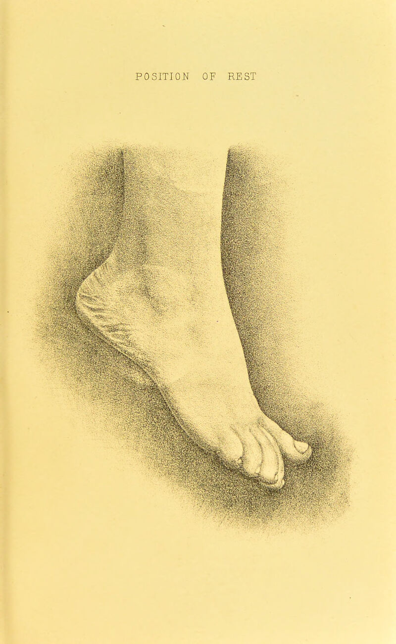 POSITION OF REST