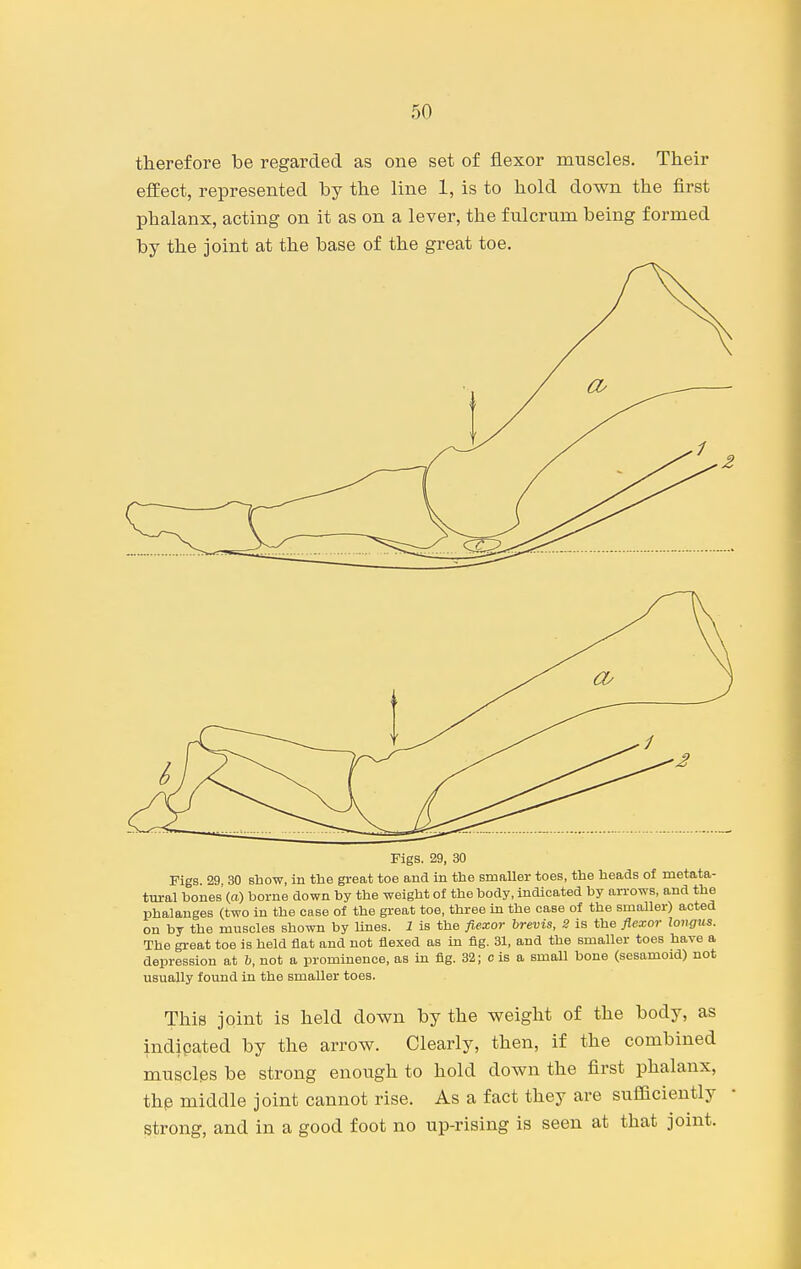 therefore be regarded as one set of flexor muscles. Their effect, represented by the line 1, is to hold down the first phalanx, acting on it as on a lever, the fulcrum being formed by the joint at the base of the great toe. Figs. 29, 30 Pigs. 29, 30 show, in the great toe and in the smaller toes, the heads of metata- tin-al hones'(a) borne down by the weight of the body, indicated by arrows, and the phalanges (two in the case of the great toe, three in the case of the smaller) acted on by the muscles shown by lines. 1 is the flexor hrevis, 2 is the flexor longus. The great toe is held flat and not flexed as in fig. 31, and the smaller toes have a depression at b, not a prominence, as in fig. 32; c is a small bone (sesamoid) not usually found in the smaller toes. This joint is held down by the weight of the body, as indicated by the arrow. Clearly, then, if the combined muscles be strong enough to hold down the first phalanx, the middle joint cannot rise. As a fact they are sufficiently strong, and in a good foot no up-rising is seen at that joint.