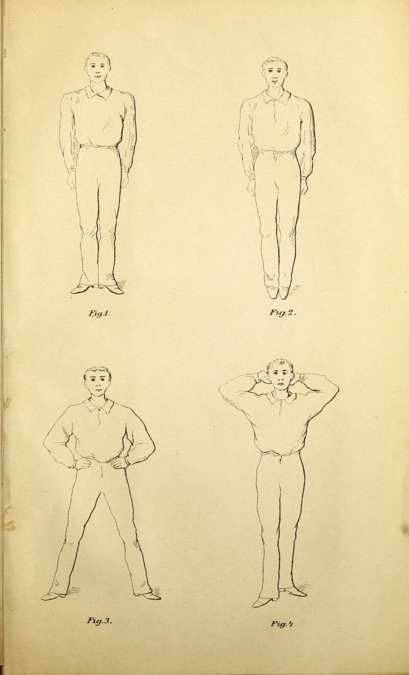Fig.3,