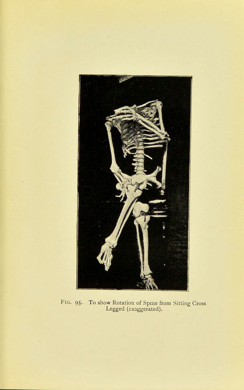 Fig. 95. To show Rotation of Spine from Sitting Cross Legged (exaggerated).